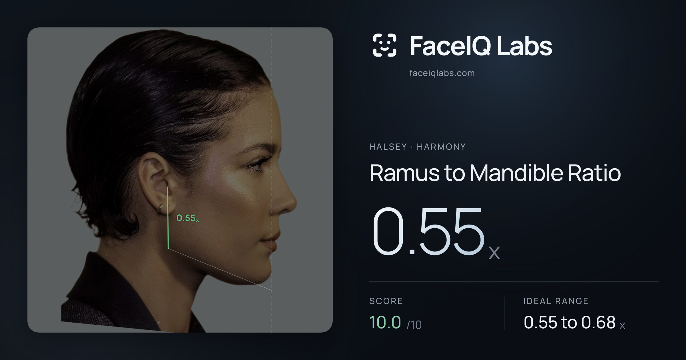 Halsey Ramus to Mandible Ratio: 0.55x, drawn on the photo