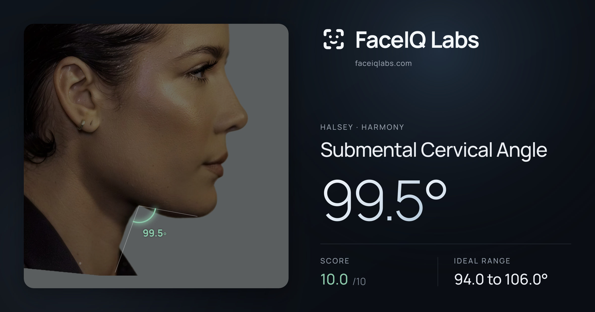 Halsey Submental Cervical Angle: 99.5°, drawn on the photo