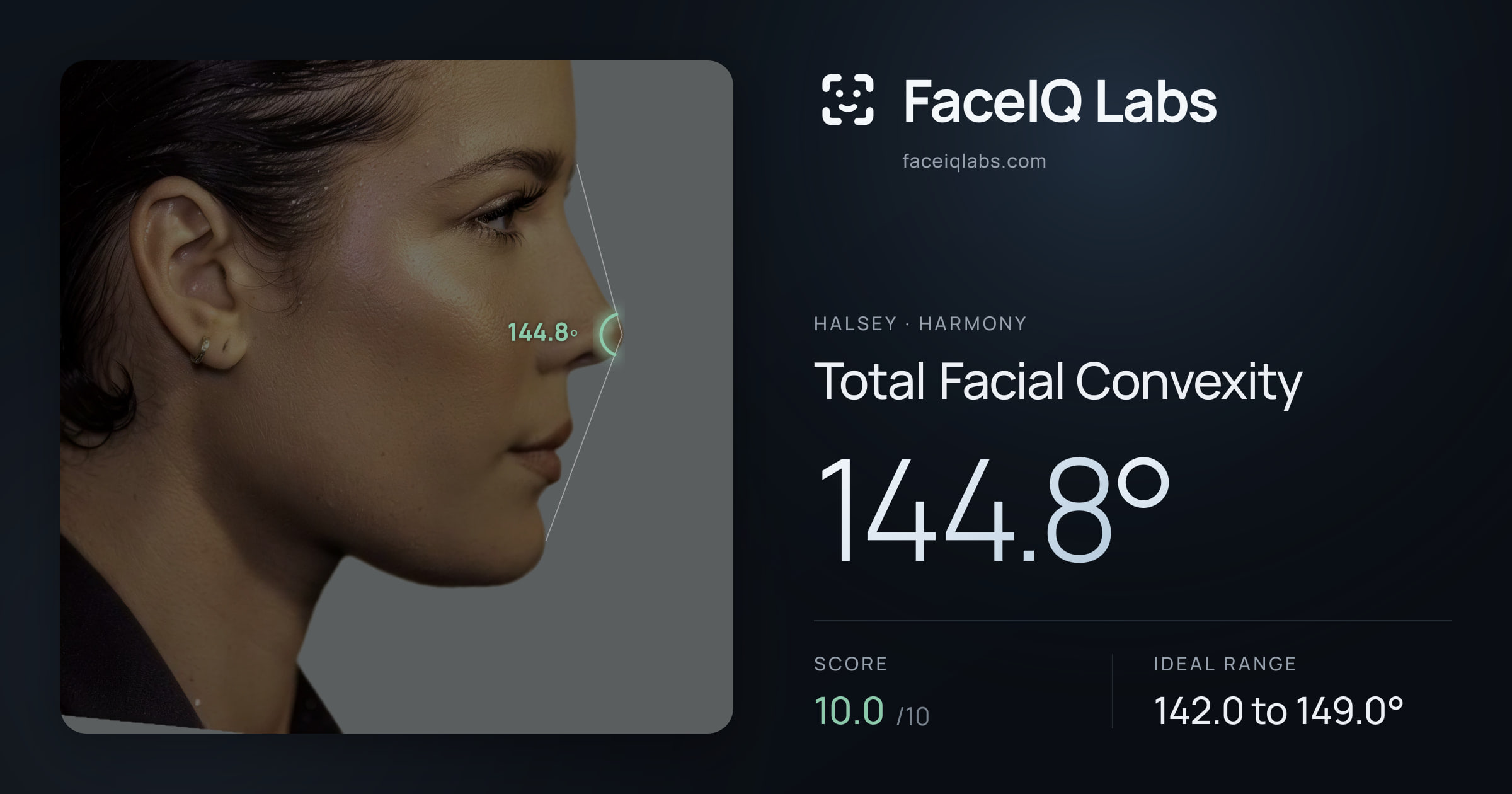 Halsey Total Facial Convexity: 144.8°, drawn on the photo