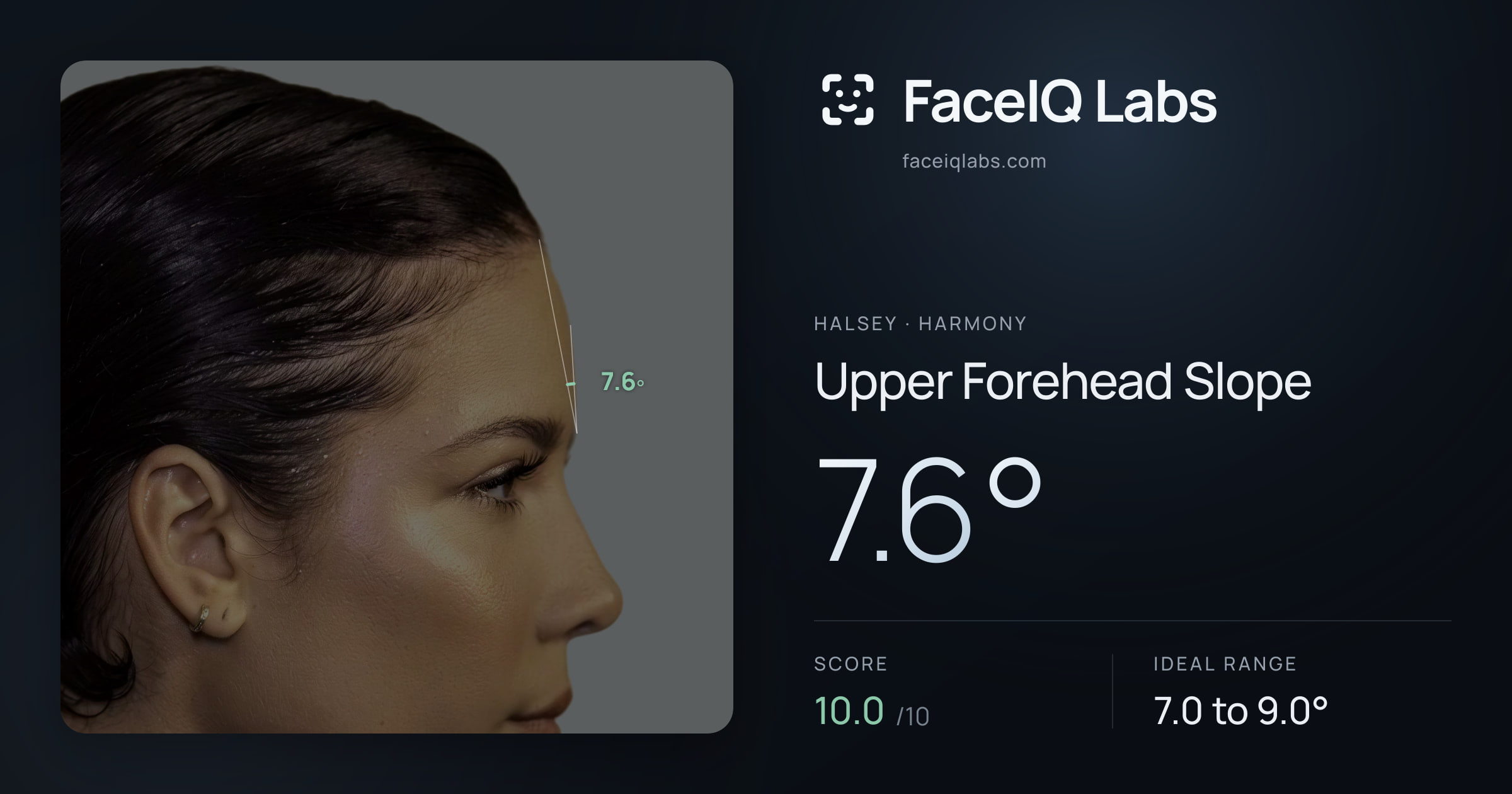 Halsey Upper Forehead Slope: 7.6°, drawn on the photo