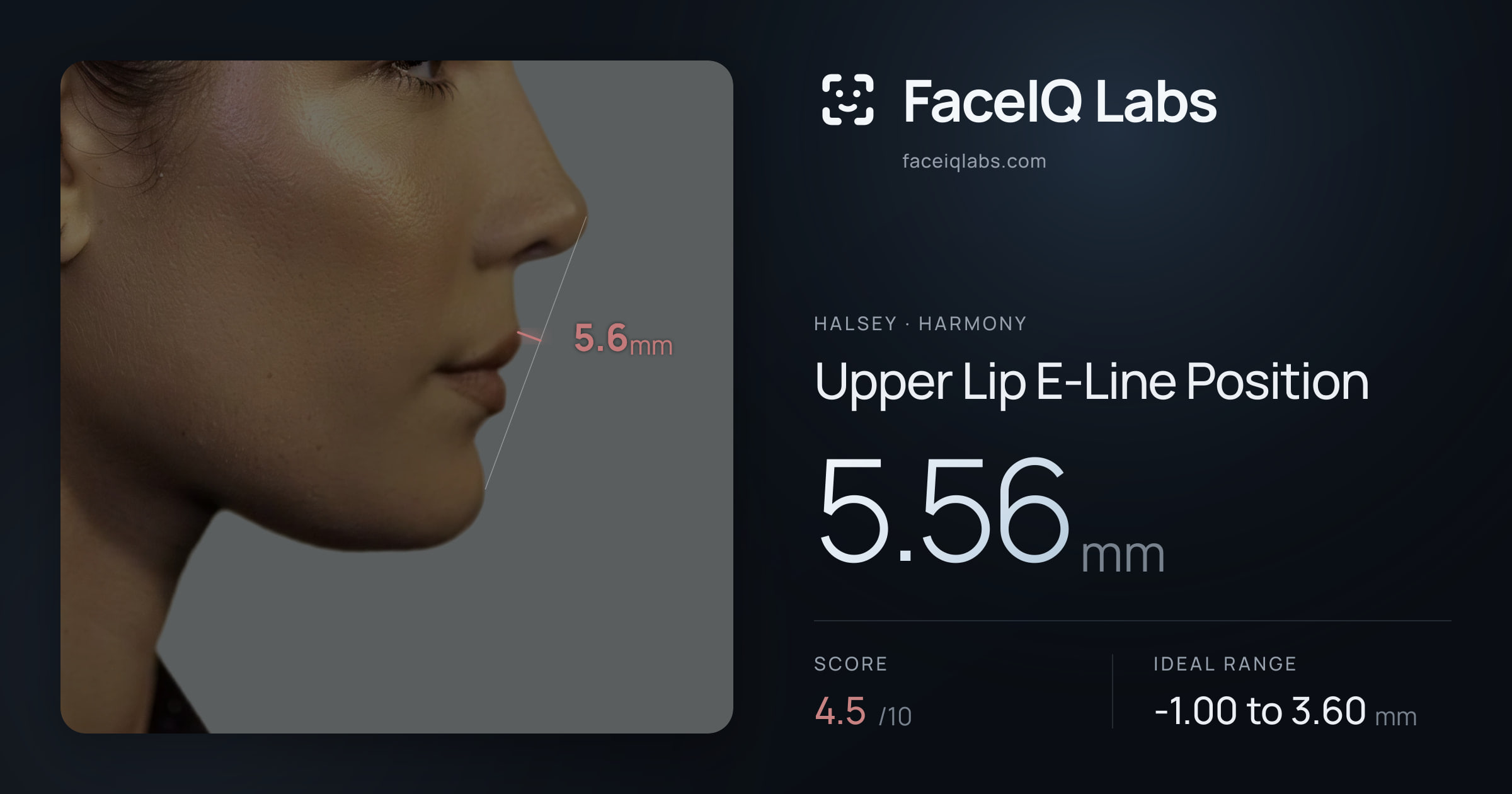 Halsey Upper Lip E-Line Position: 5.56mm, drawn on the photo