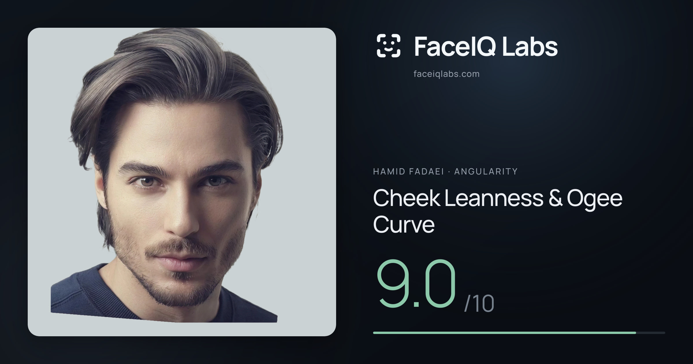 Hamid Fadaei Cheek Leanness & Ogee Curve: 9.0/10, drawn on the photo