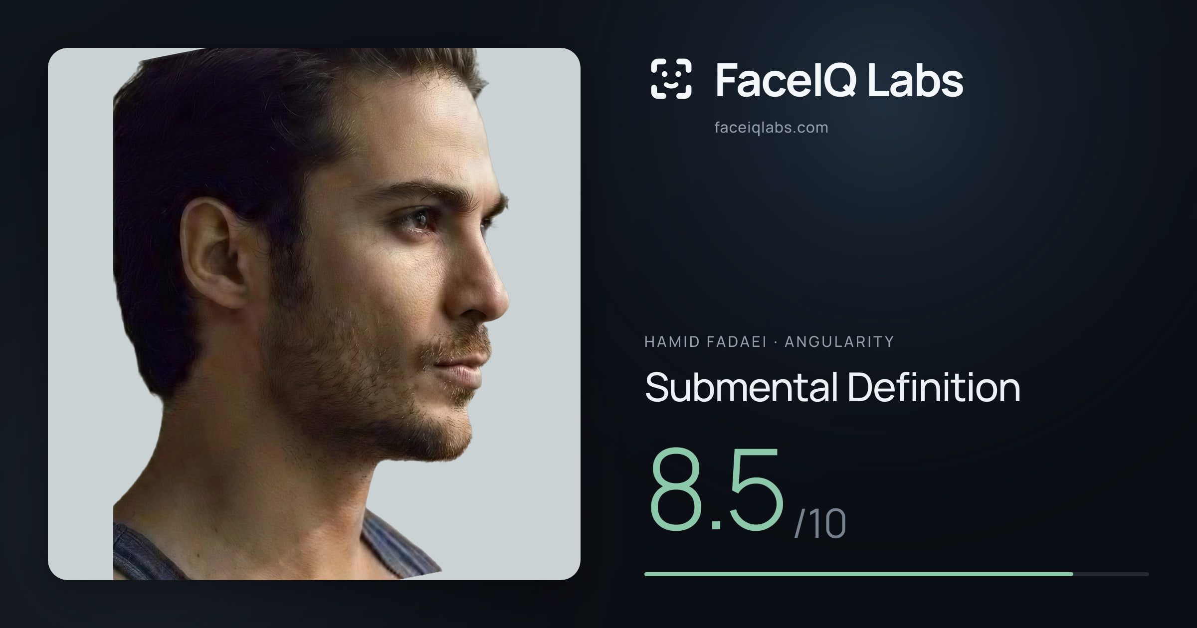 Hamid Fadaei Submental Definition: 8.5/10, drawn on the photo