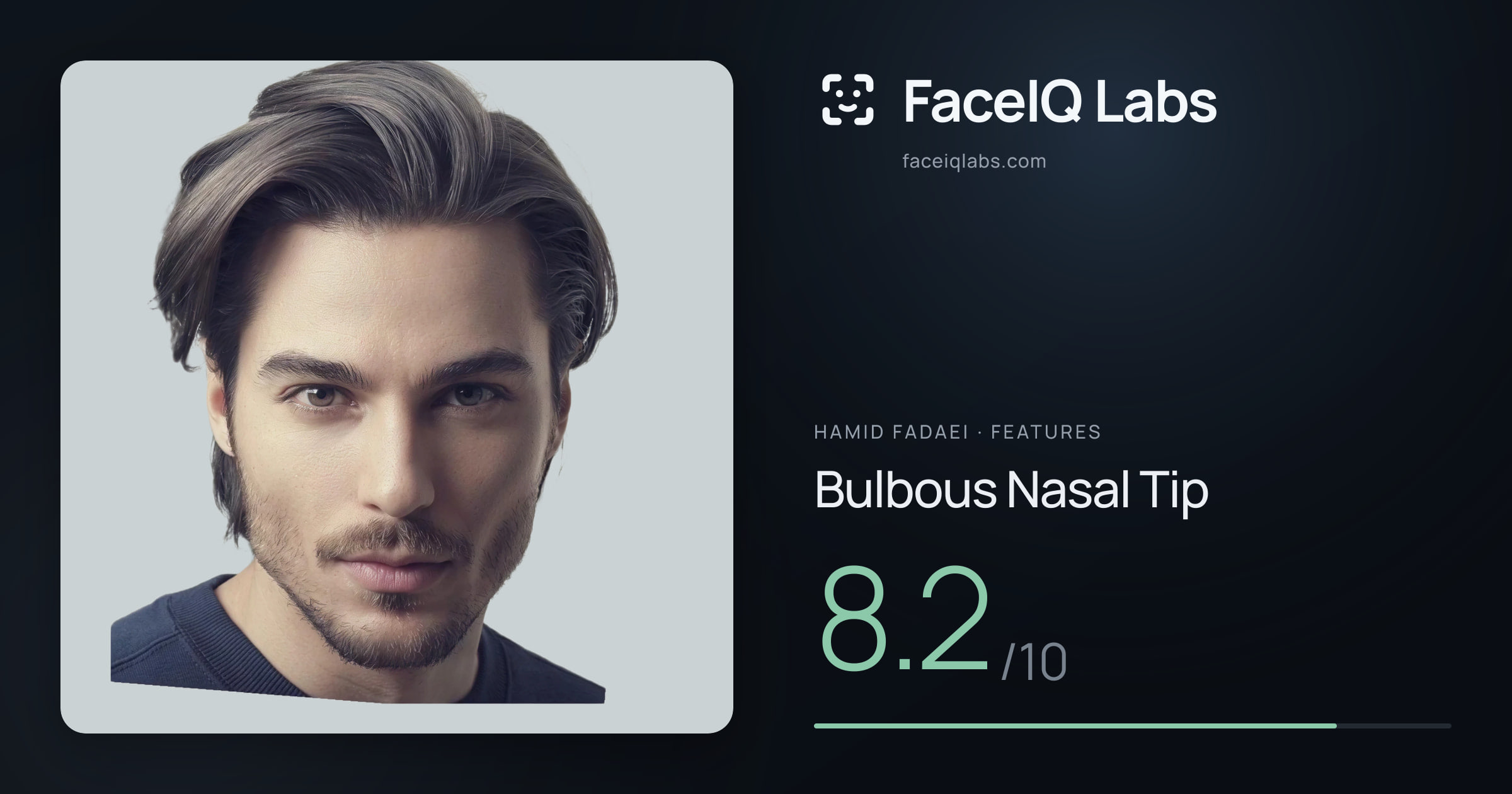 Hamid Fadaei Bulbous Nasal Tip: 8.2/10, drawn on the photo