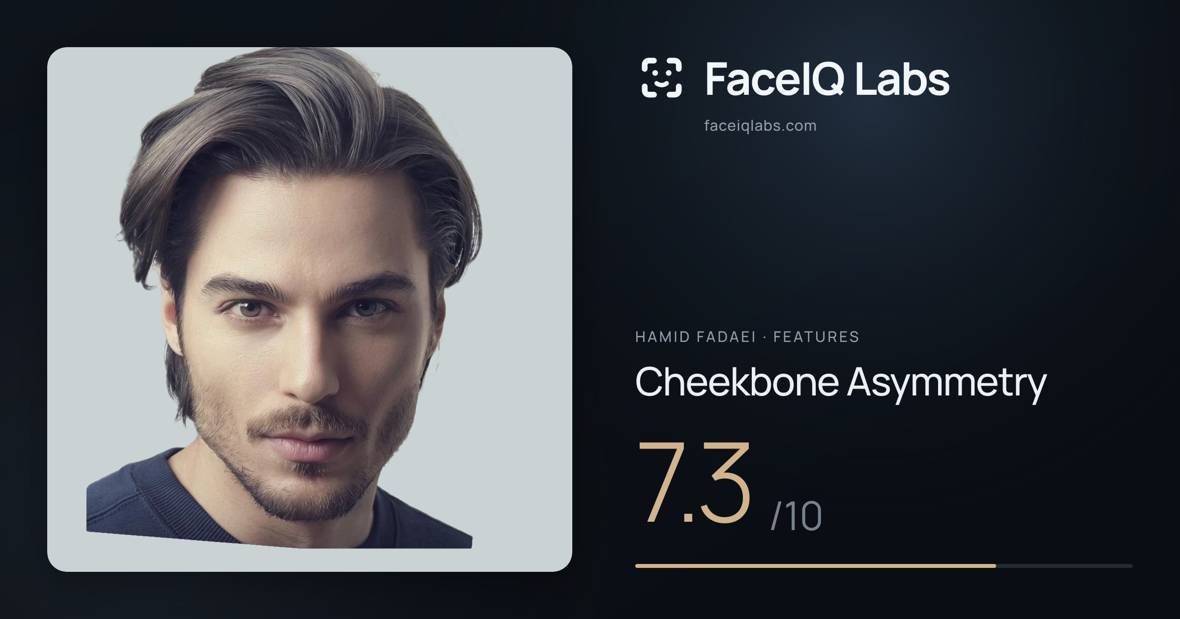Hamid Fadaei Cheekbone Asymmetry: 7.3/10, drawn on the photo