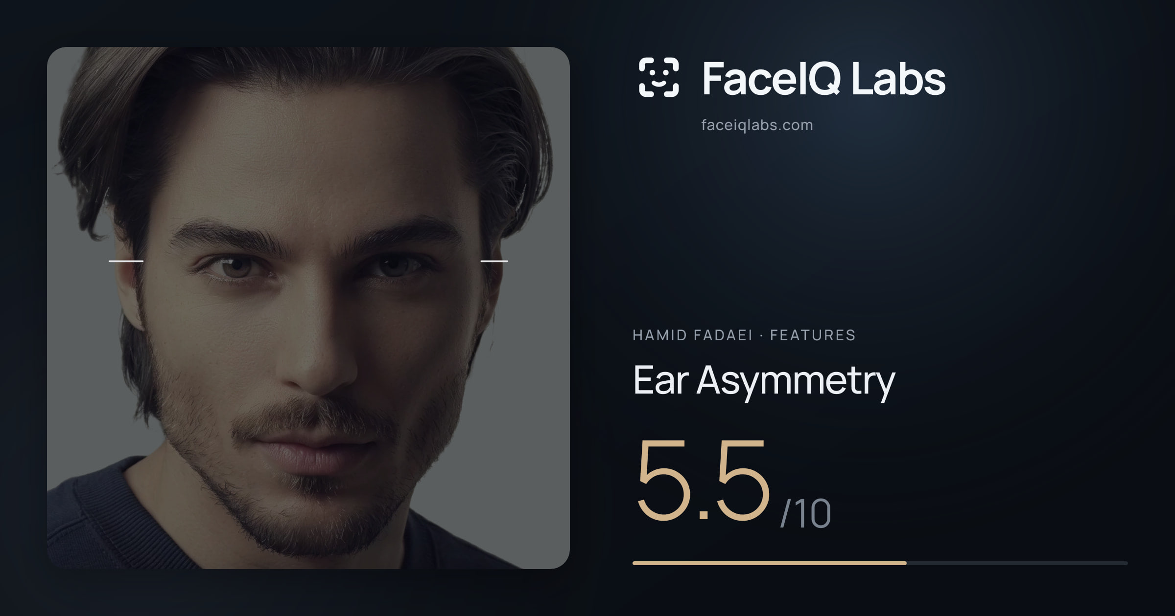Hamid Fadaei Ear Asymmetry: 5.5/10, drawn on the photo