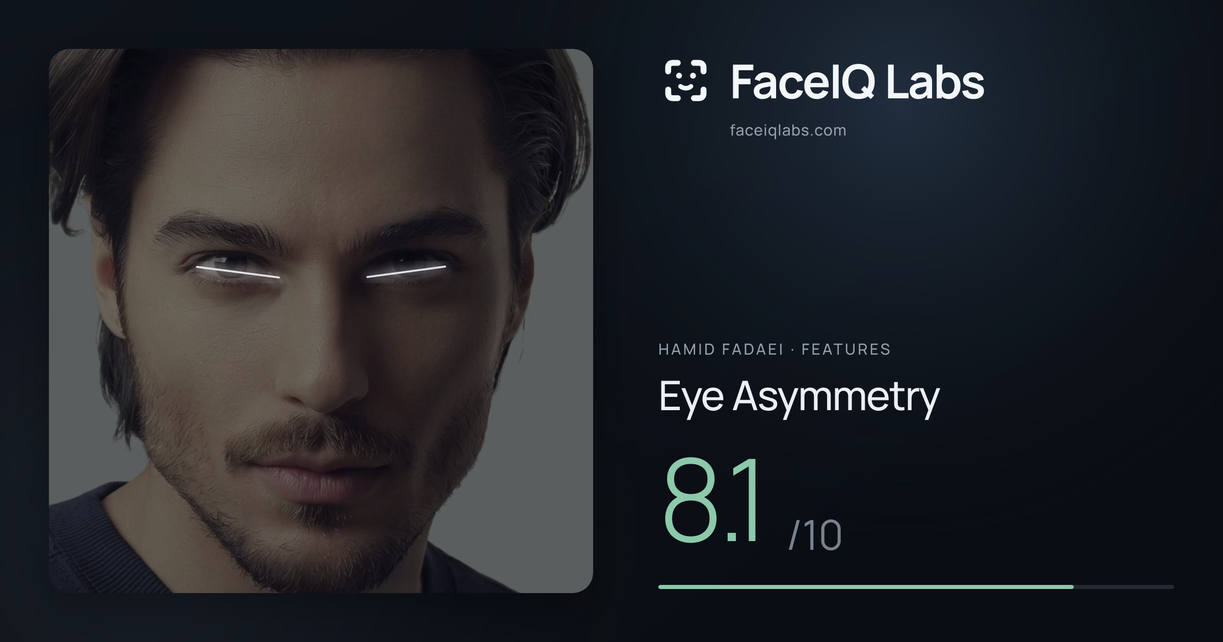Hamid Fadaei Eye Asymmetry: 8.1/10, drawn on the photo