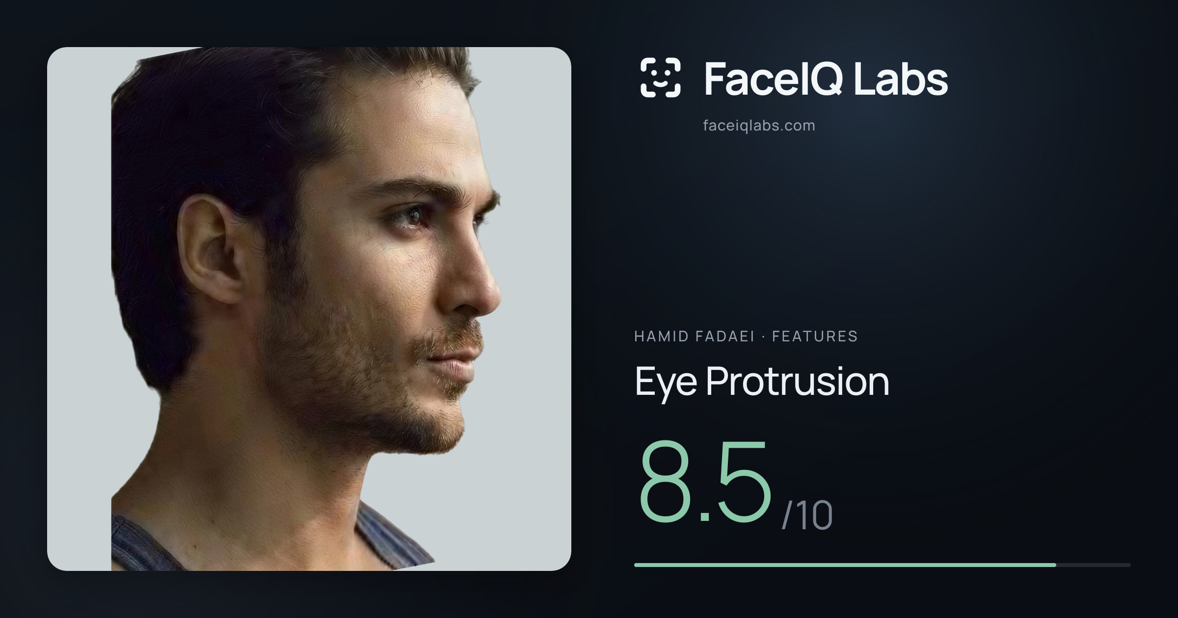 Hamid Fadaei Eye Protrusion: 8.5/10, drawn on the photo