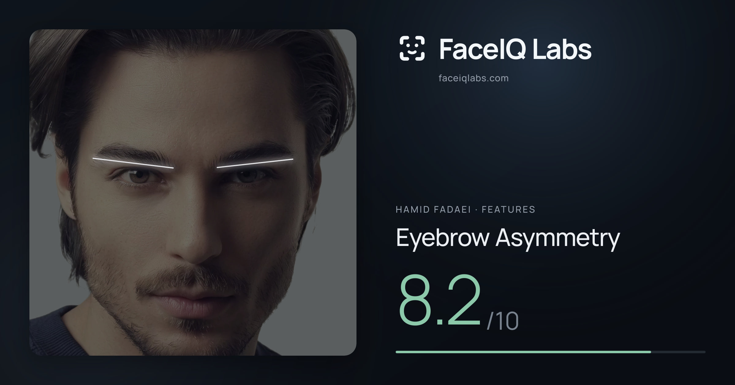 Hamid Fadaei Eyebrow Asymmetry: 8.2/10, drawn on the photo