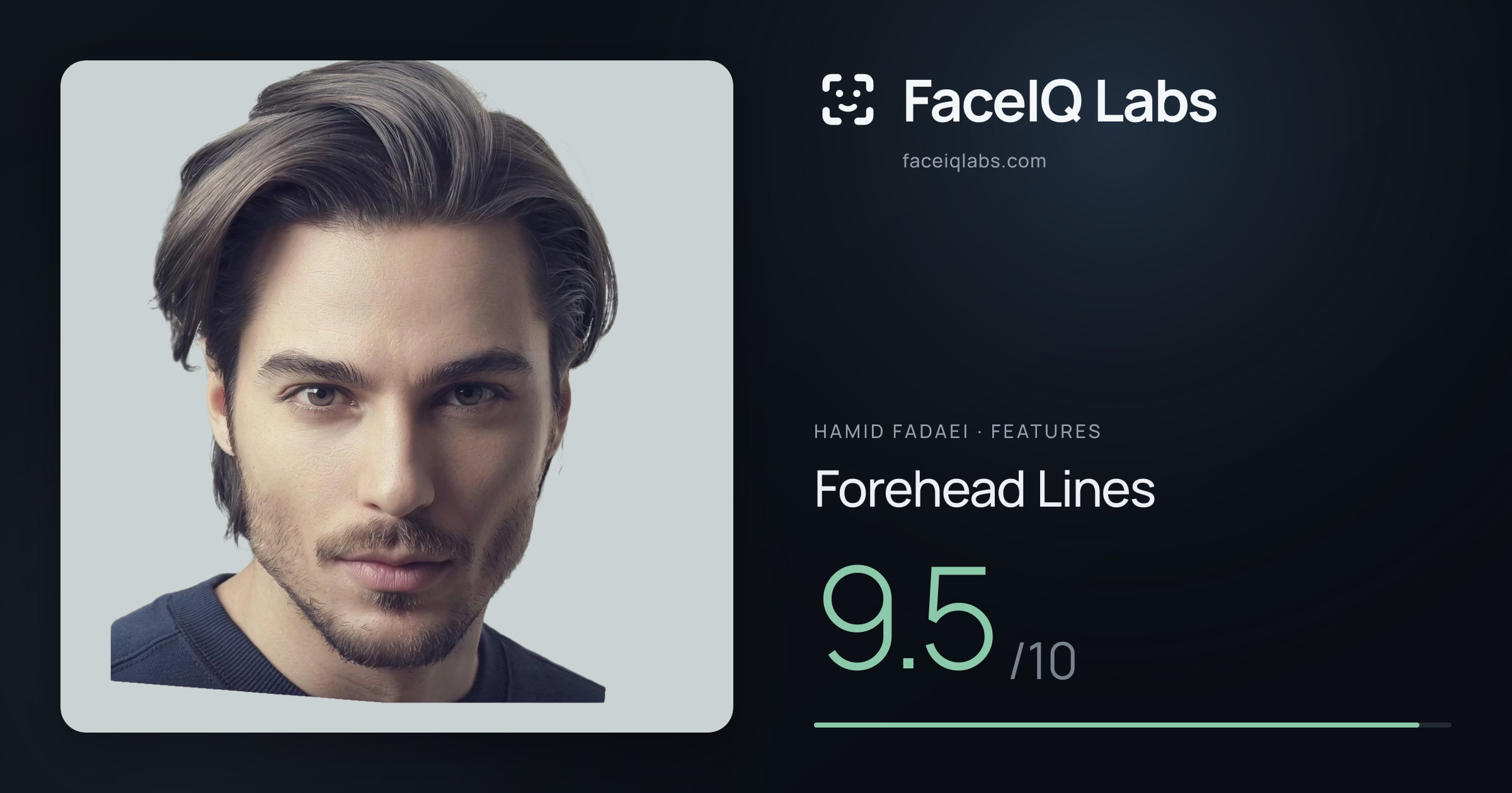 Hamid Fadaei Forehead Lines: 9.5/10, drawn on the photo