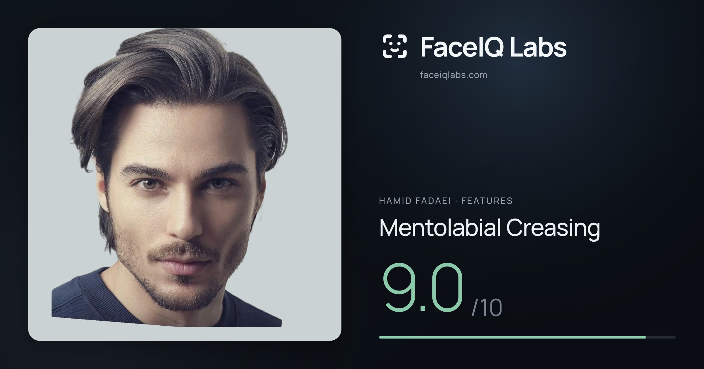 Hamid Fadaei Mentolabial Creasing: 9.0/10, drawn on the photo