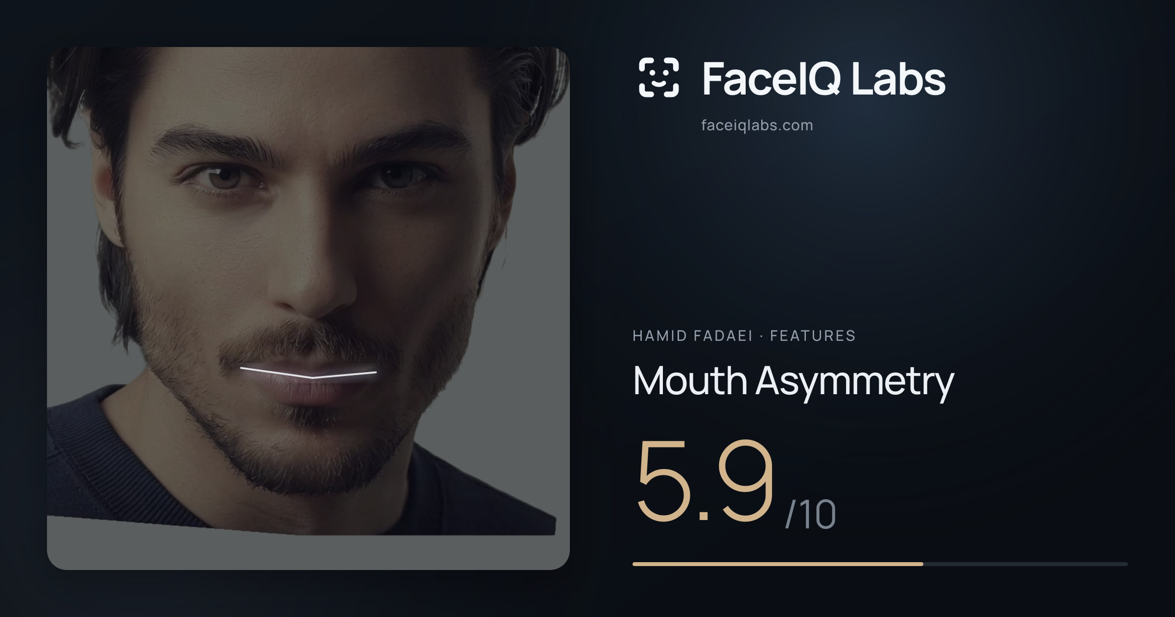 Hamid Fadaei Mouth Asymmetry: 5.9/10, drawn on the photo