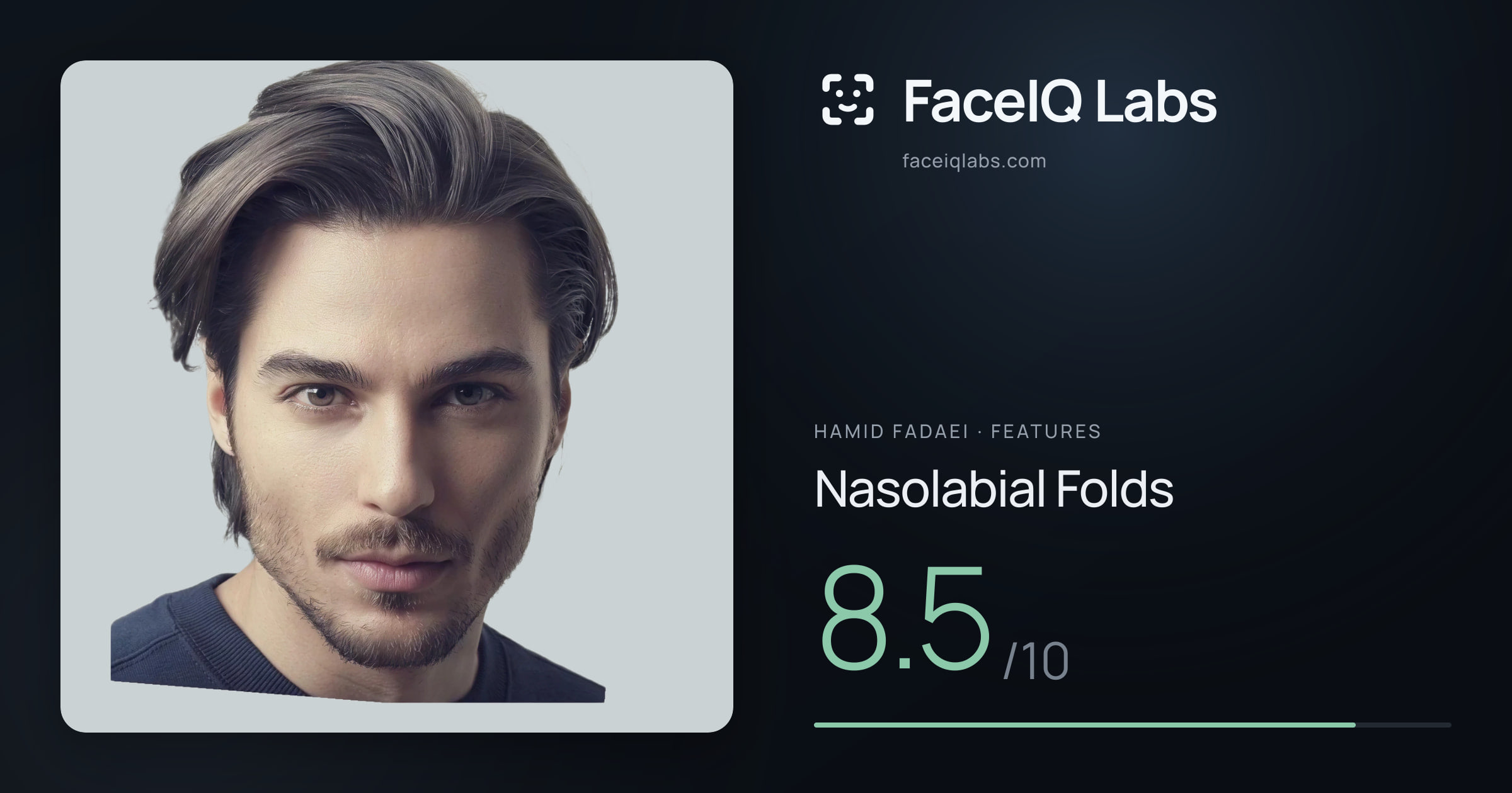 Hamid Fadaei Nasolabial Folds: 8.5/10, drawn on the photo