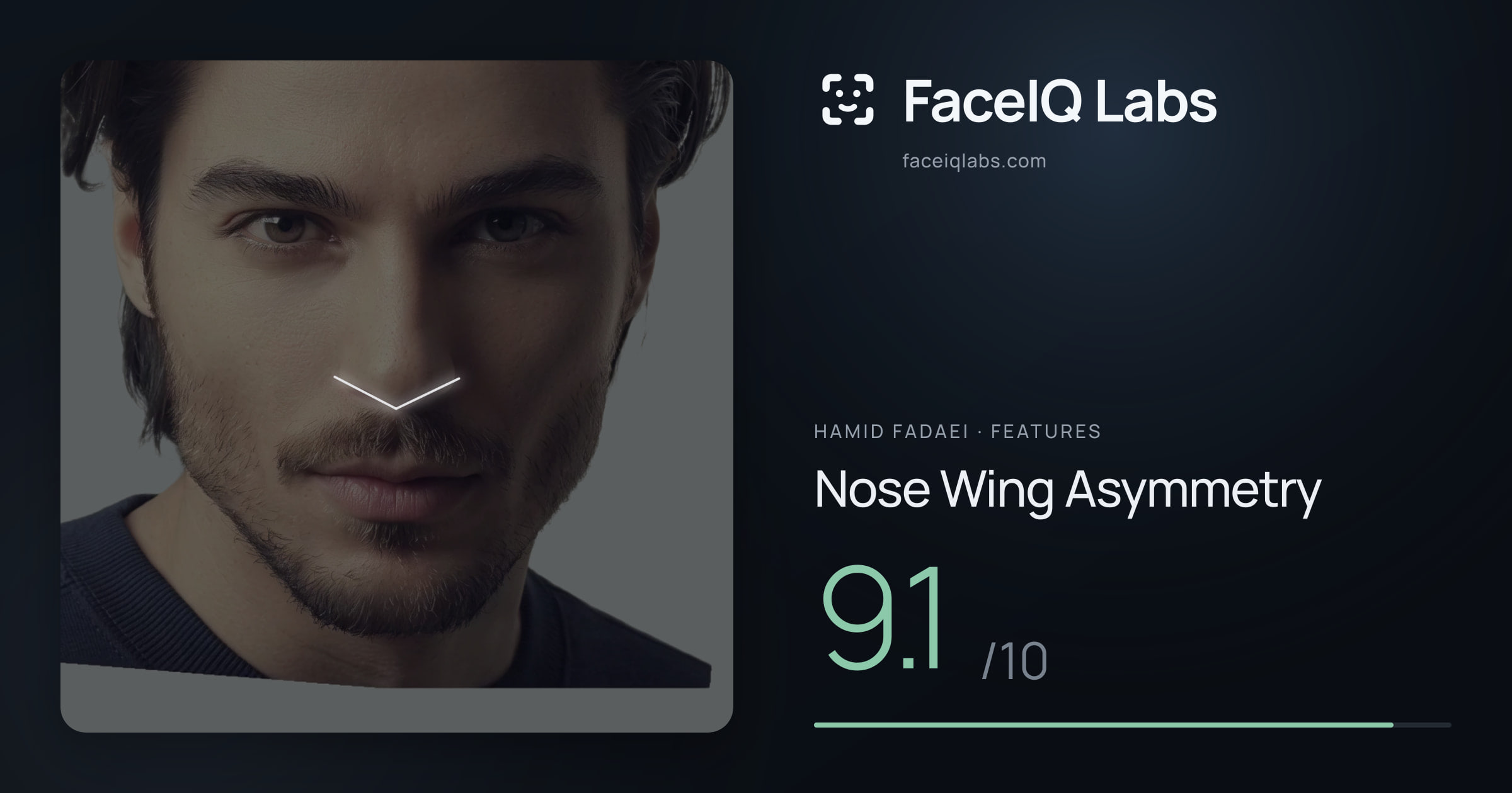 Hamid Fadaei Nose Wing Asymmetry: 9.1/10, drawn on the photo