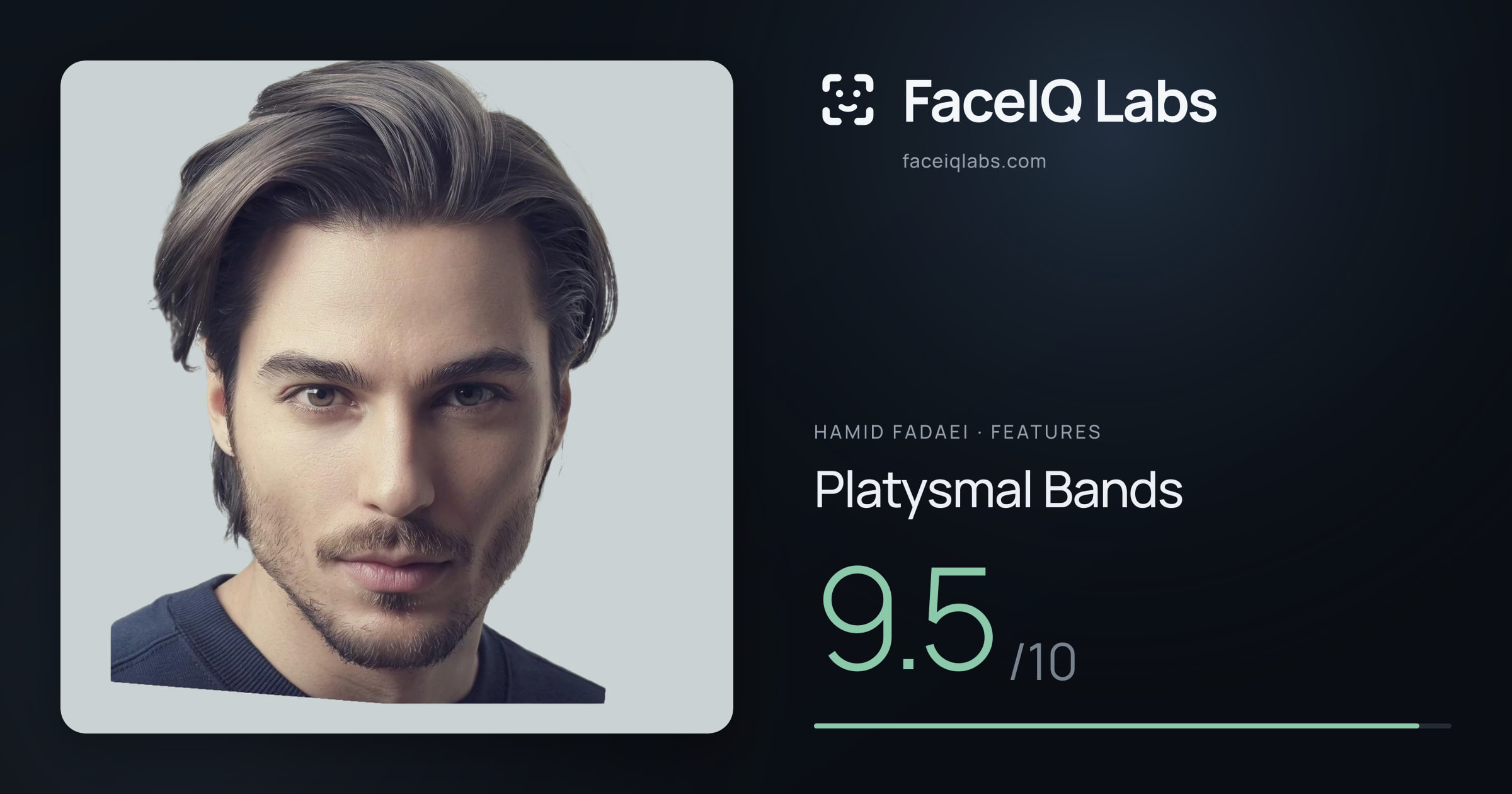 Hamid Fadaei Platysmal Bands: 9.5/10, drawn on the photo