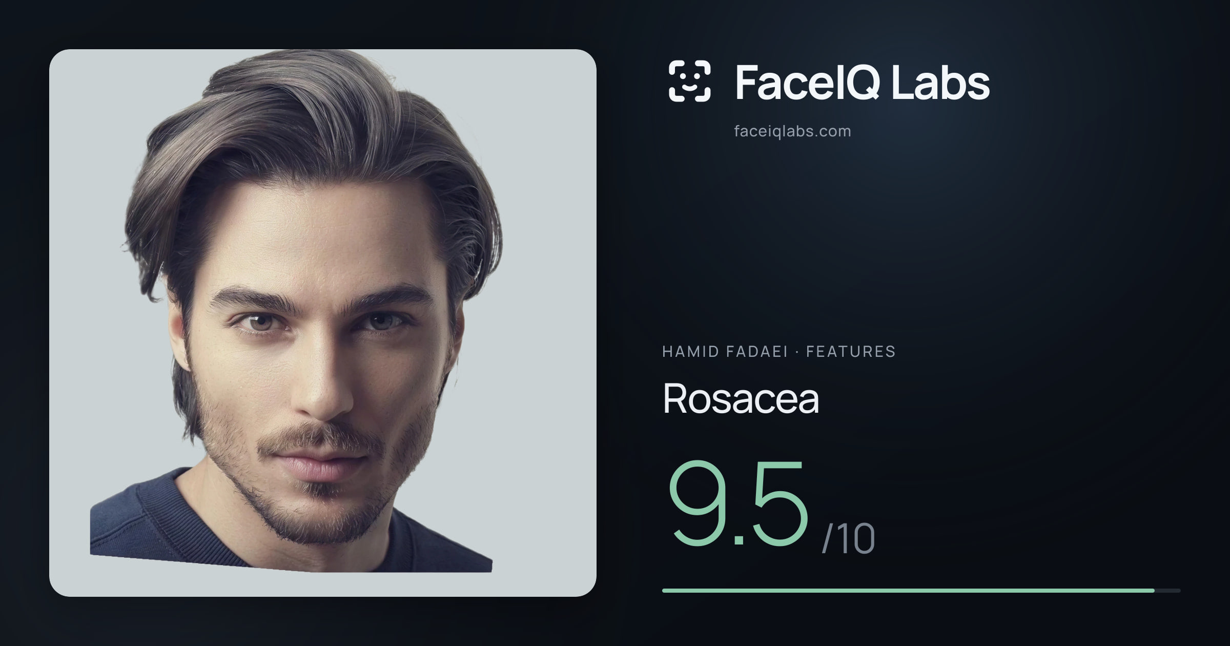 Hamid Fadaei Rosacea: 9.5/10, drawn on the photo