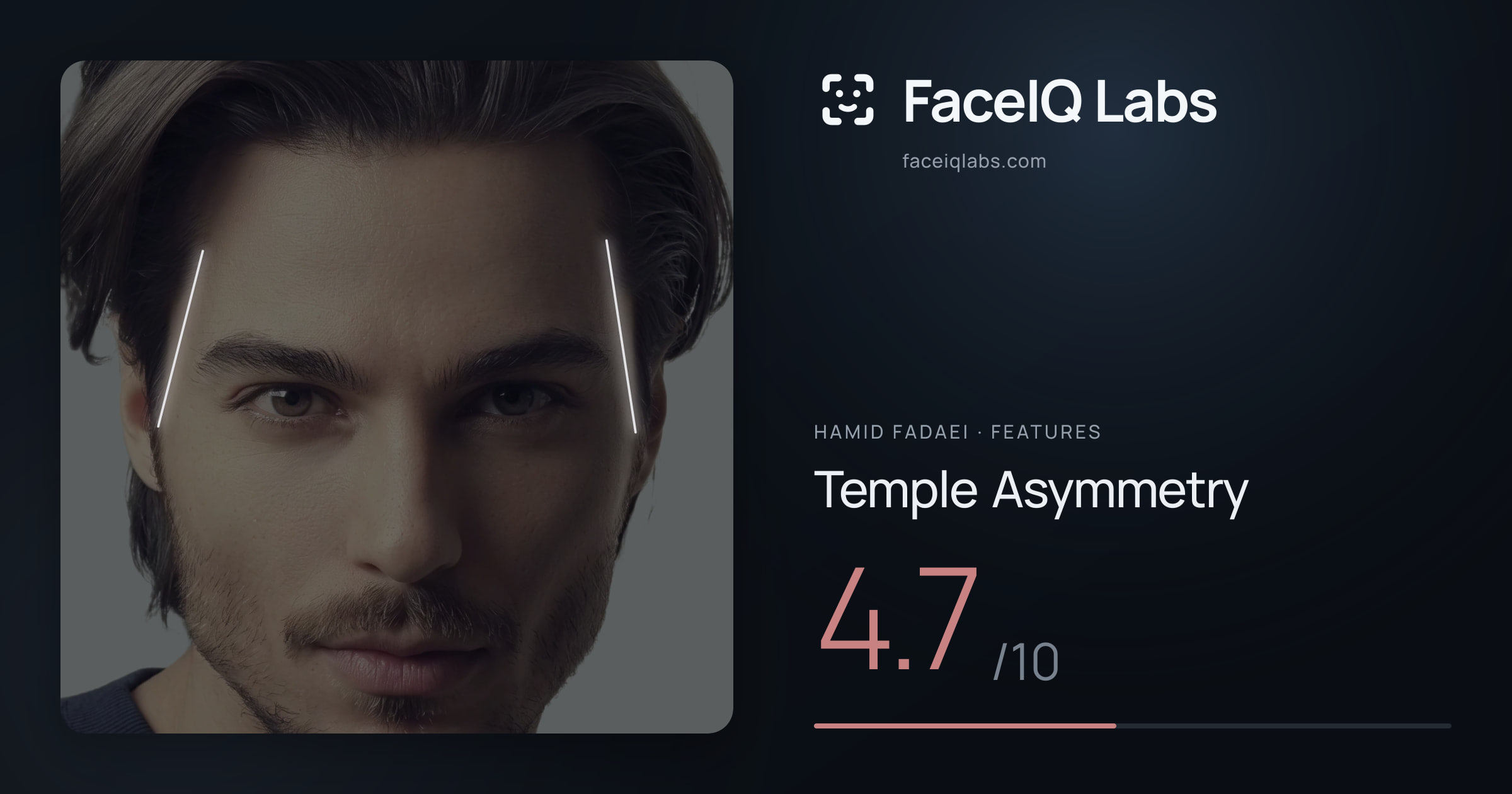 Hamid Fadaei Temple Asymmetry: 4.7/10, drawn on the photo