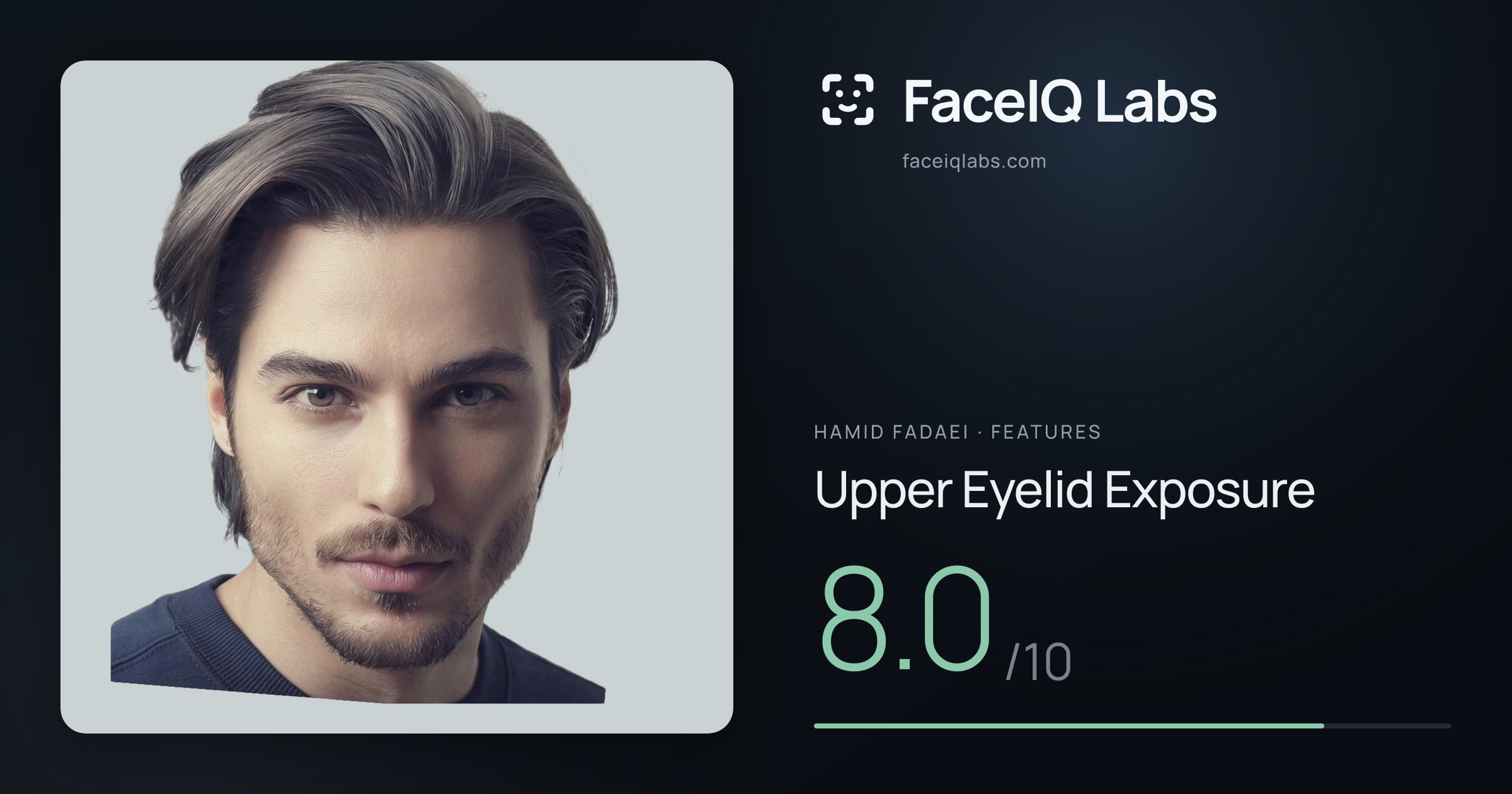 Hamid Fadaei Upper Eyelid Exposure: 8.0/10, drawn on the photo