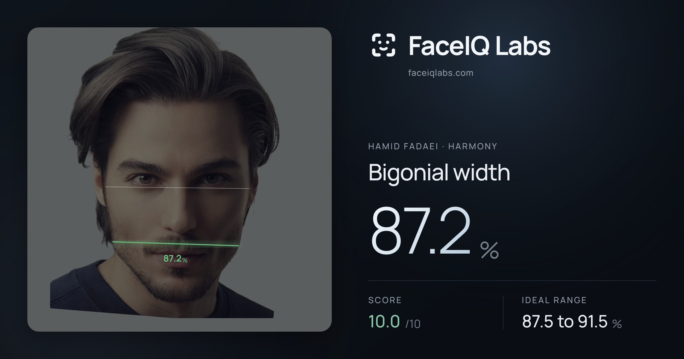 Hamid Fadaei Bigonial width: 87.2%, drawn on the photo