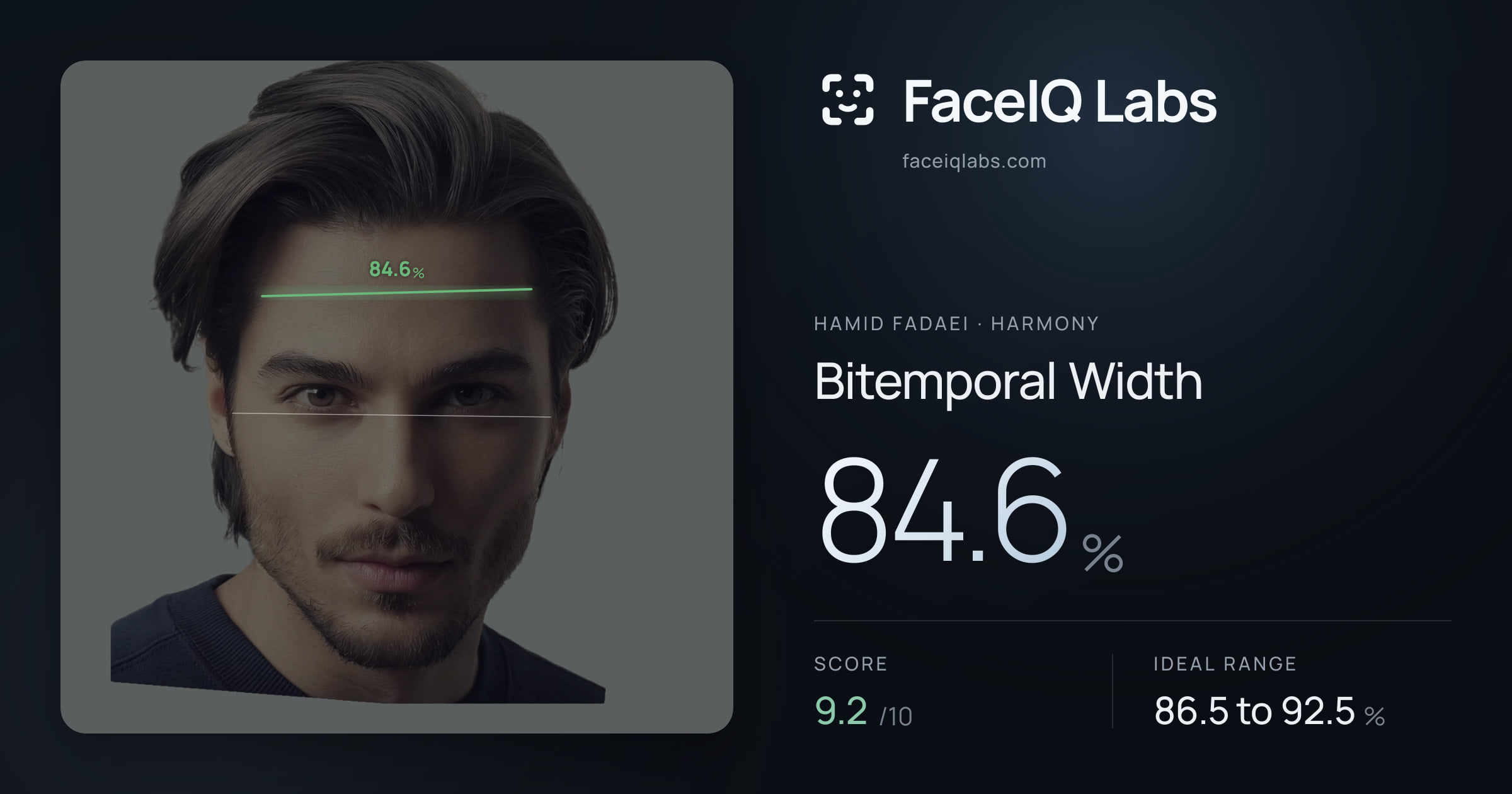 Hamid Fadaei Bitemporal Width: 84.6%, drawn on the photo