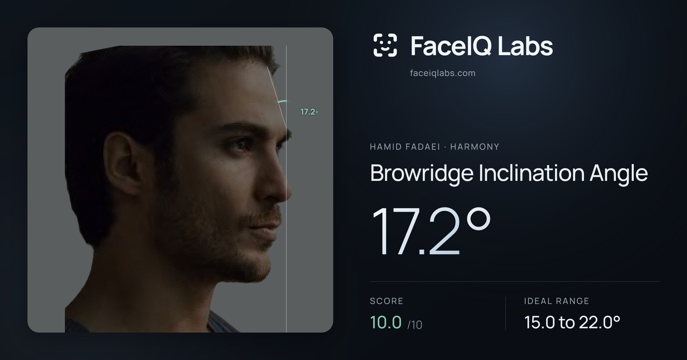 Hamid Fadaei Browridge Inclination Angle: 17.2°, drawn on the photo