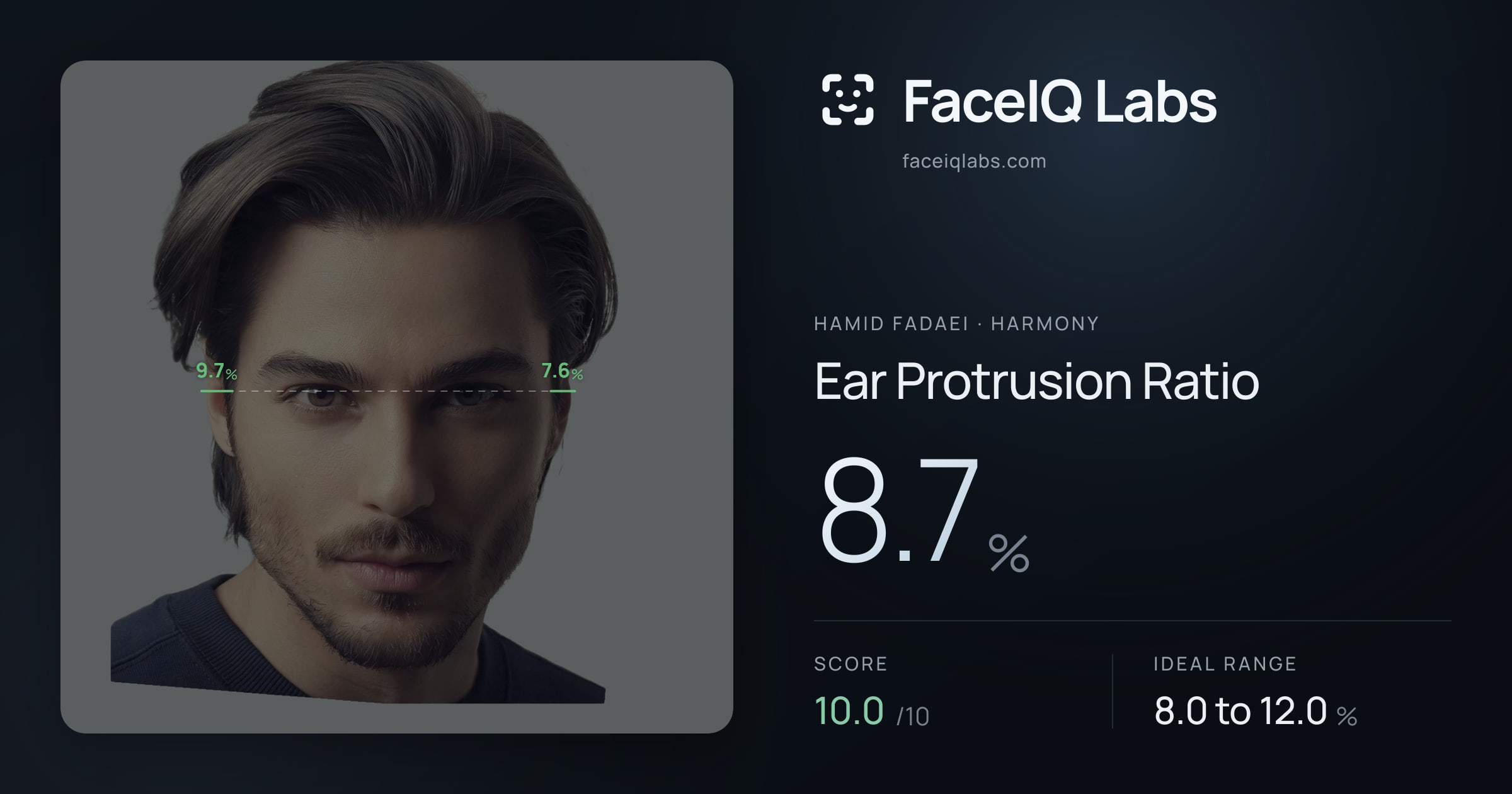 Hamid Fadaei Ear Protrusion Ratio: 8.7%, drawn on the photo