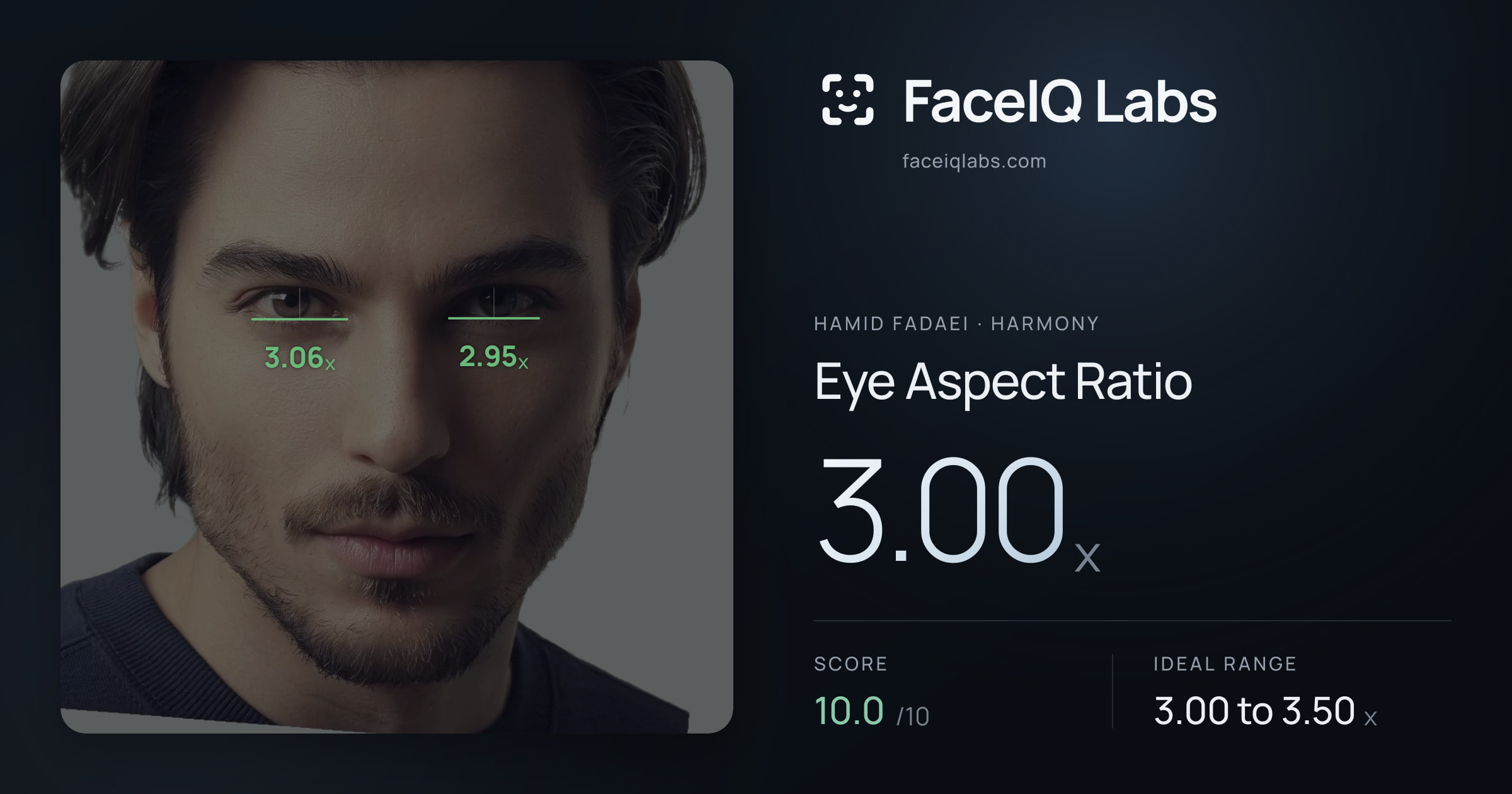 Hamid Fadaei Eye Aspect Ratio: 3.00x, drawn on the photo