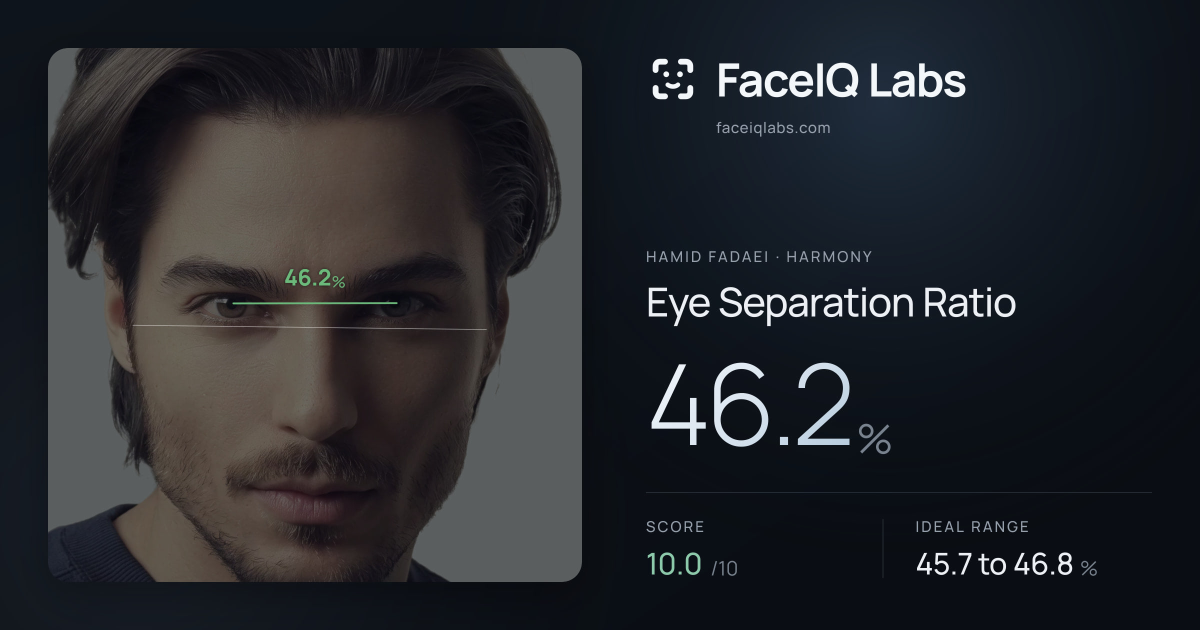 Hamid Fadaei Eye Separation Ratio: 46.2%, drawn on the photo