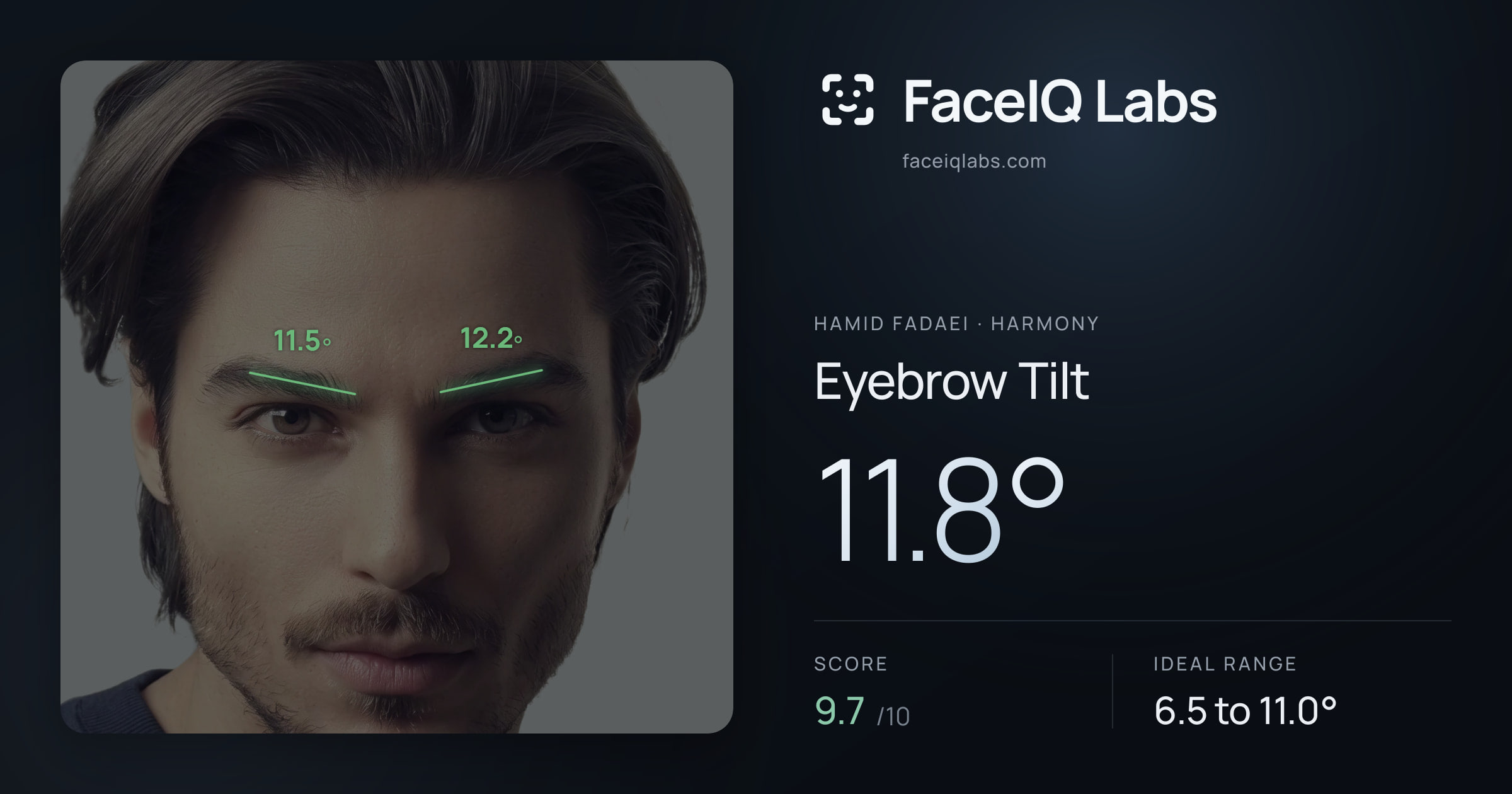 Hamid Fadaei Eyebrow Tilt: 11.8°, drawn on the photo