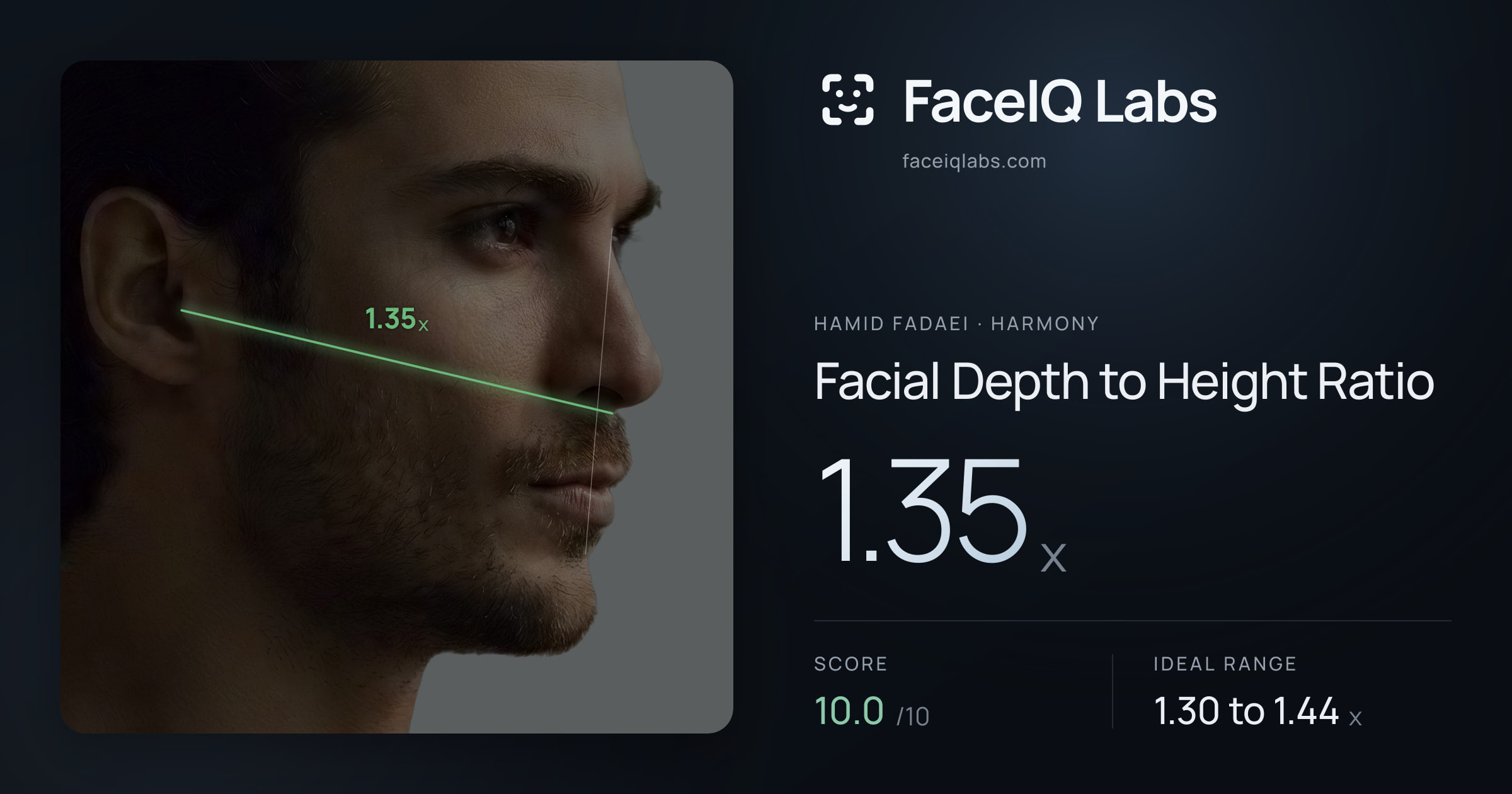 Hamid Fadaei Facial Depth to Height Ratio: 1.35x, drawn on the photo