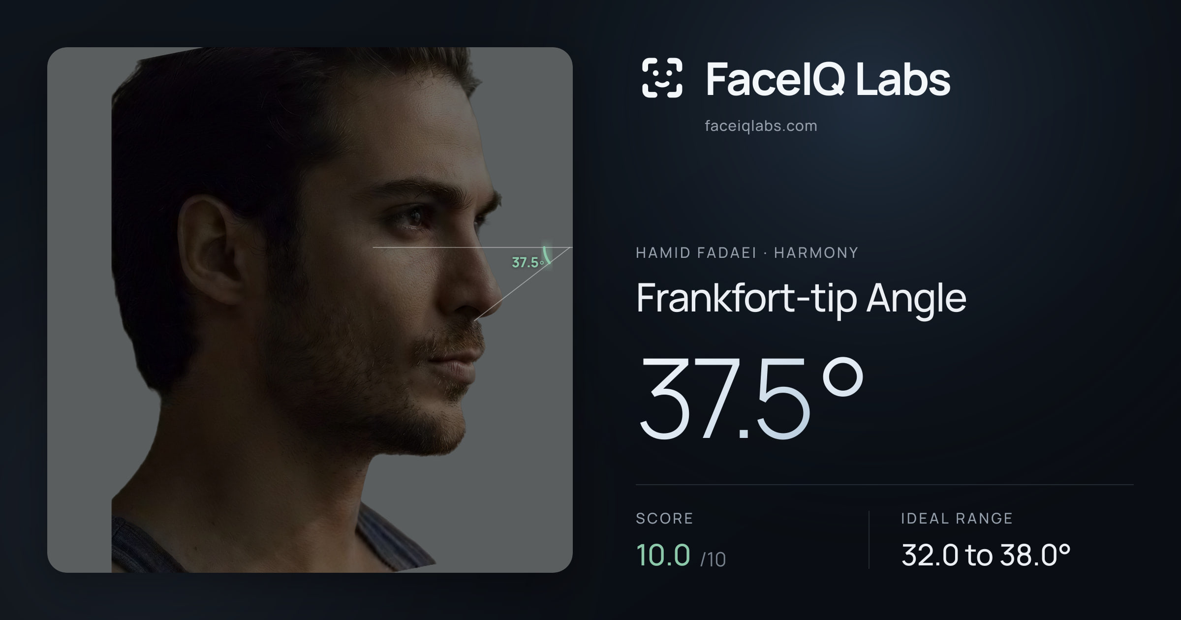 Hamid Fadaei Frankfort-tip Angle: 37.5°, drawn on the photo