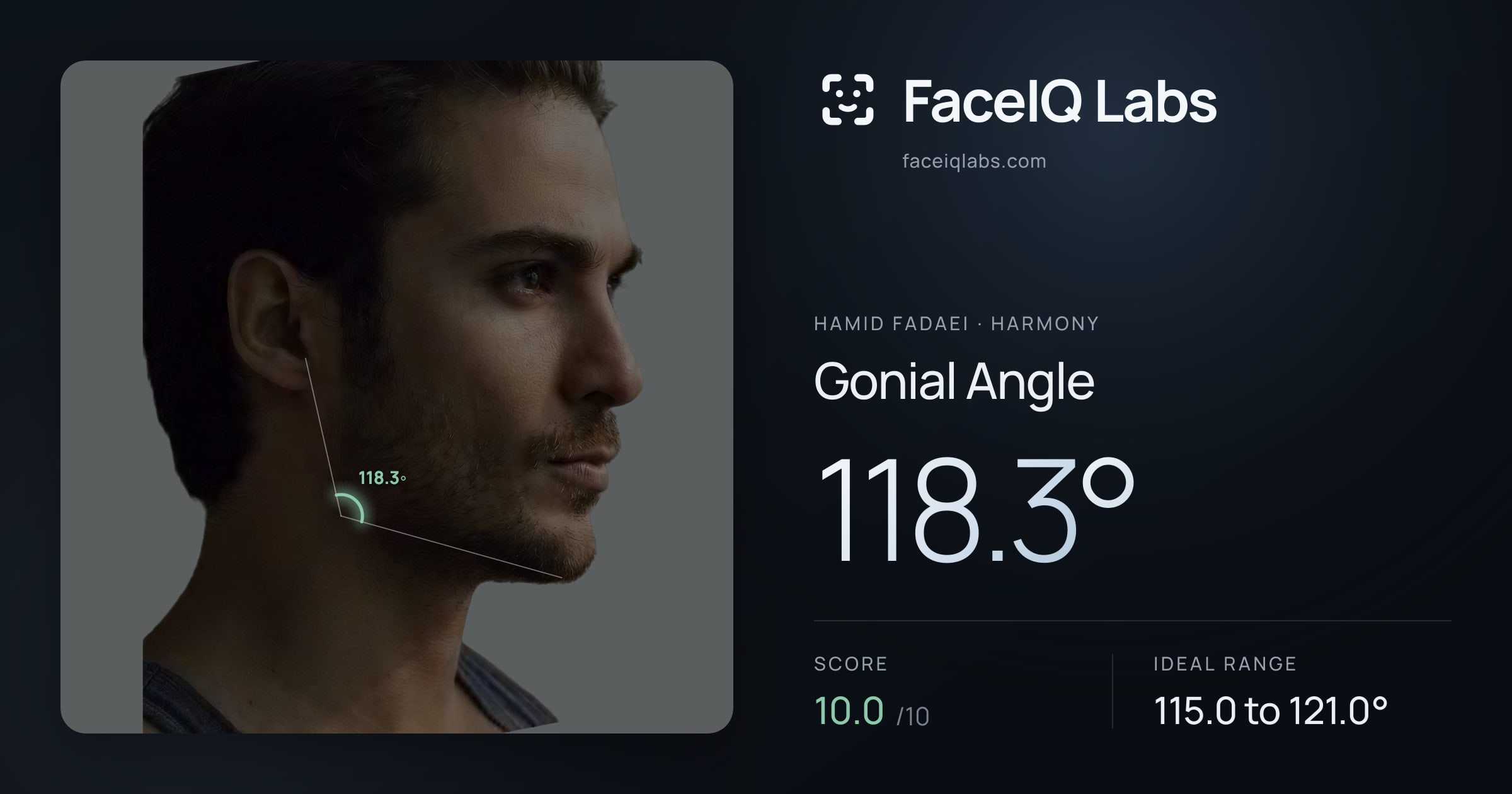 Hamid Fadaei Gonial Angle: 118.3°, drawn on the photo