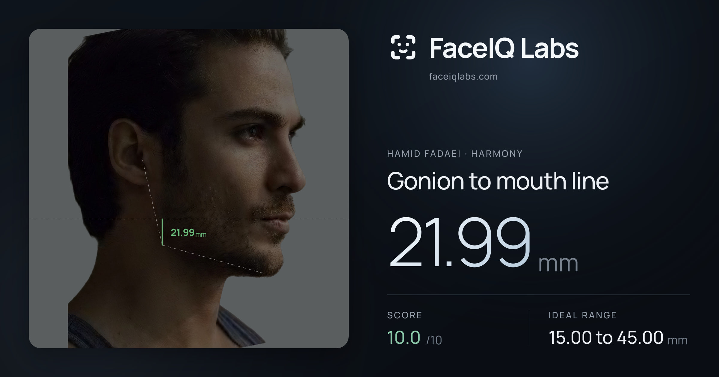 Hamid Fadaei Gonion to mouth line: 21.99mm, drawn on the photo