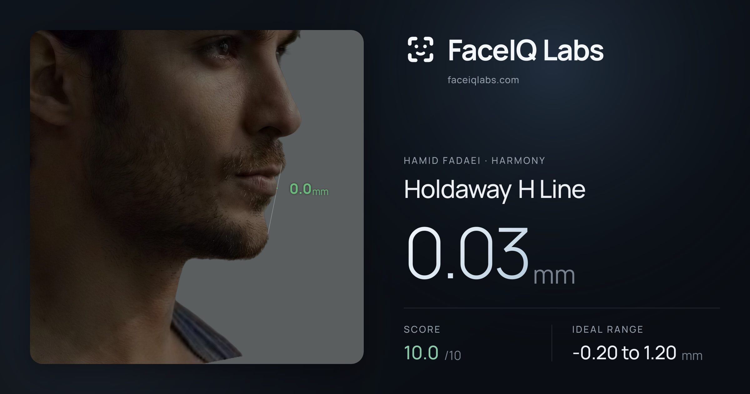 Hamid Fadaei Holdaway H Line: 0.03mm, drawn on the photo