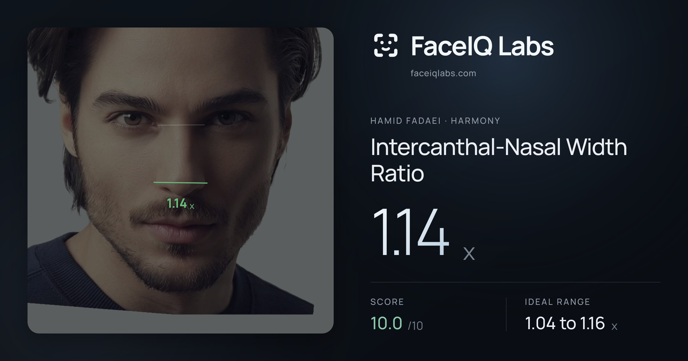 Hamid Fadaei Intercanthal-Nasal Width Ratio: 1.14x, drawn on the photo