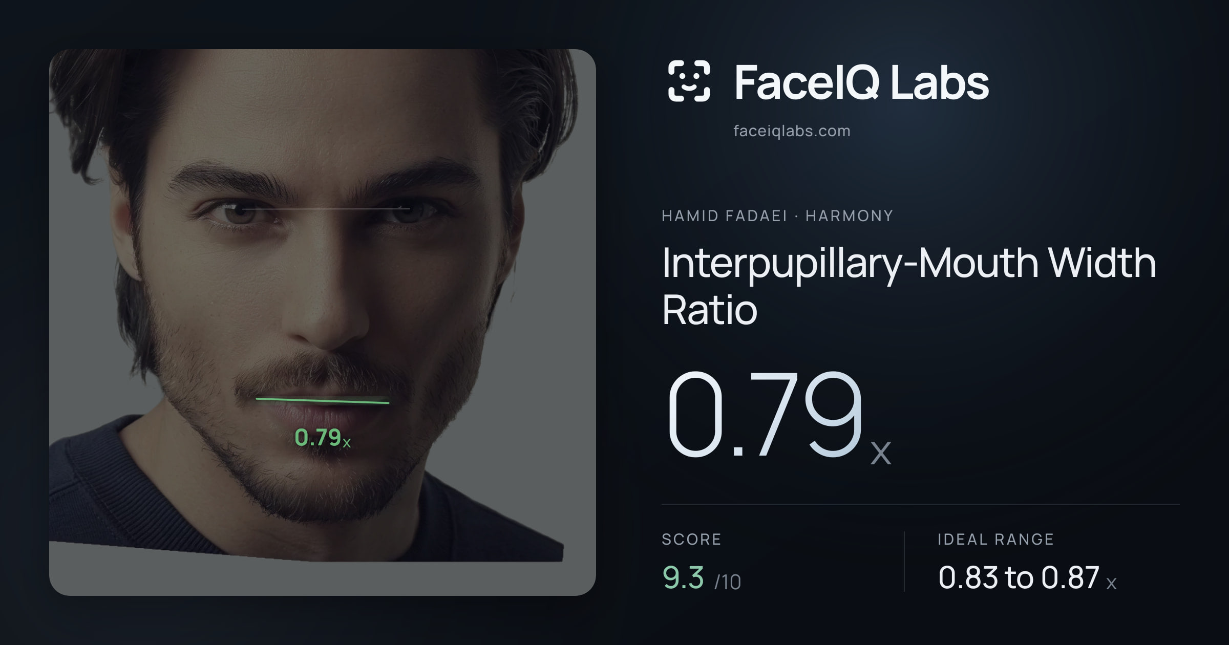 Hamid Fadaei Interpupillary-Mouth Width Ratio: 0.79x, drawn on the photo