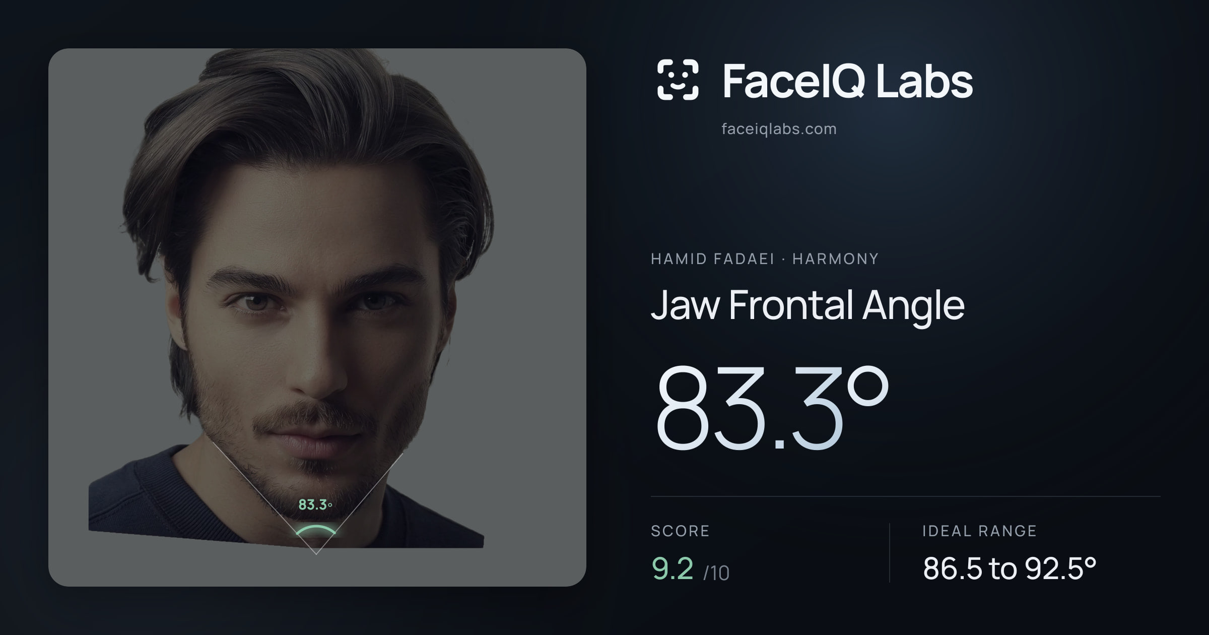 Hamid Fadaei Jaw Frontal Angle: 83.3°, drawn on the photo
