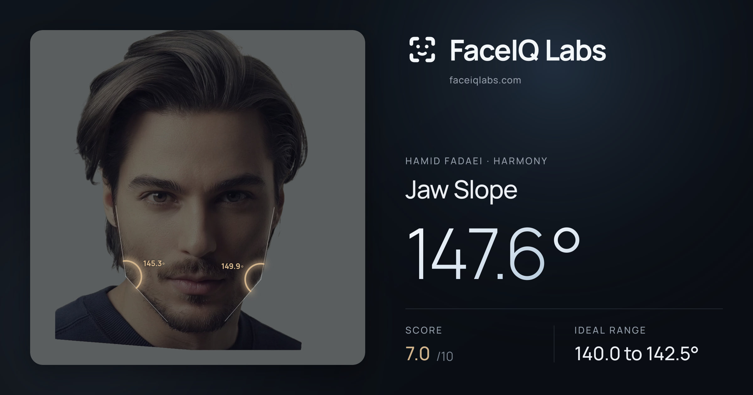 Hamid Fadaei Jaw Slope: 147.6°, drawn on the photo
