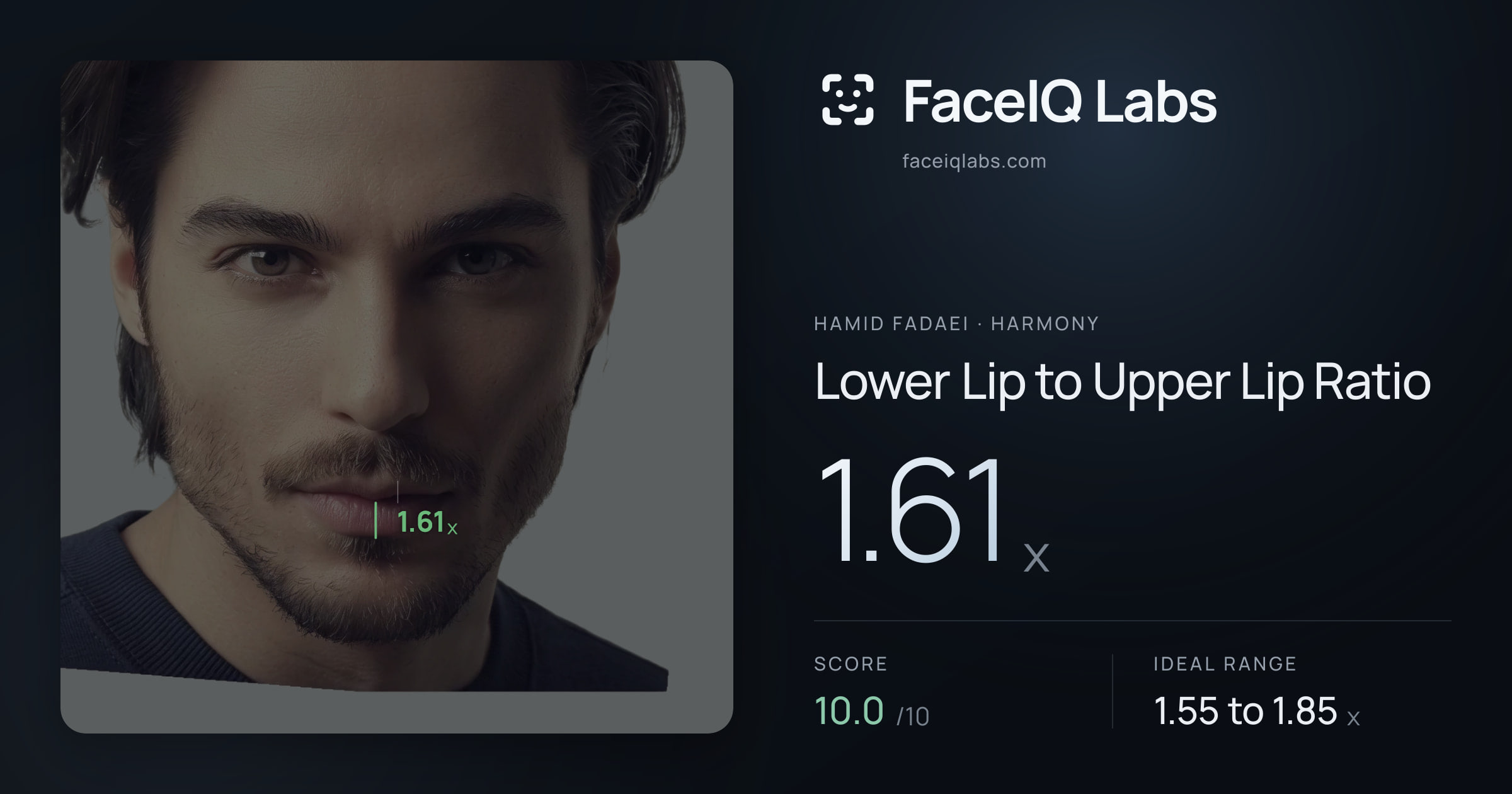 Hamid Fadaei Lower Lip to Upper Lip Ratio: 1.61x, drawn on the photo