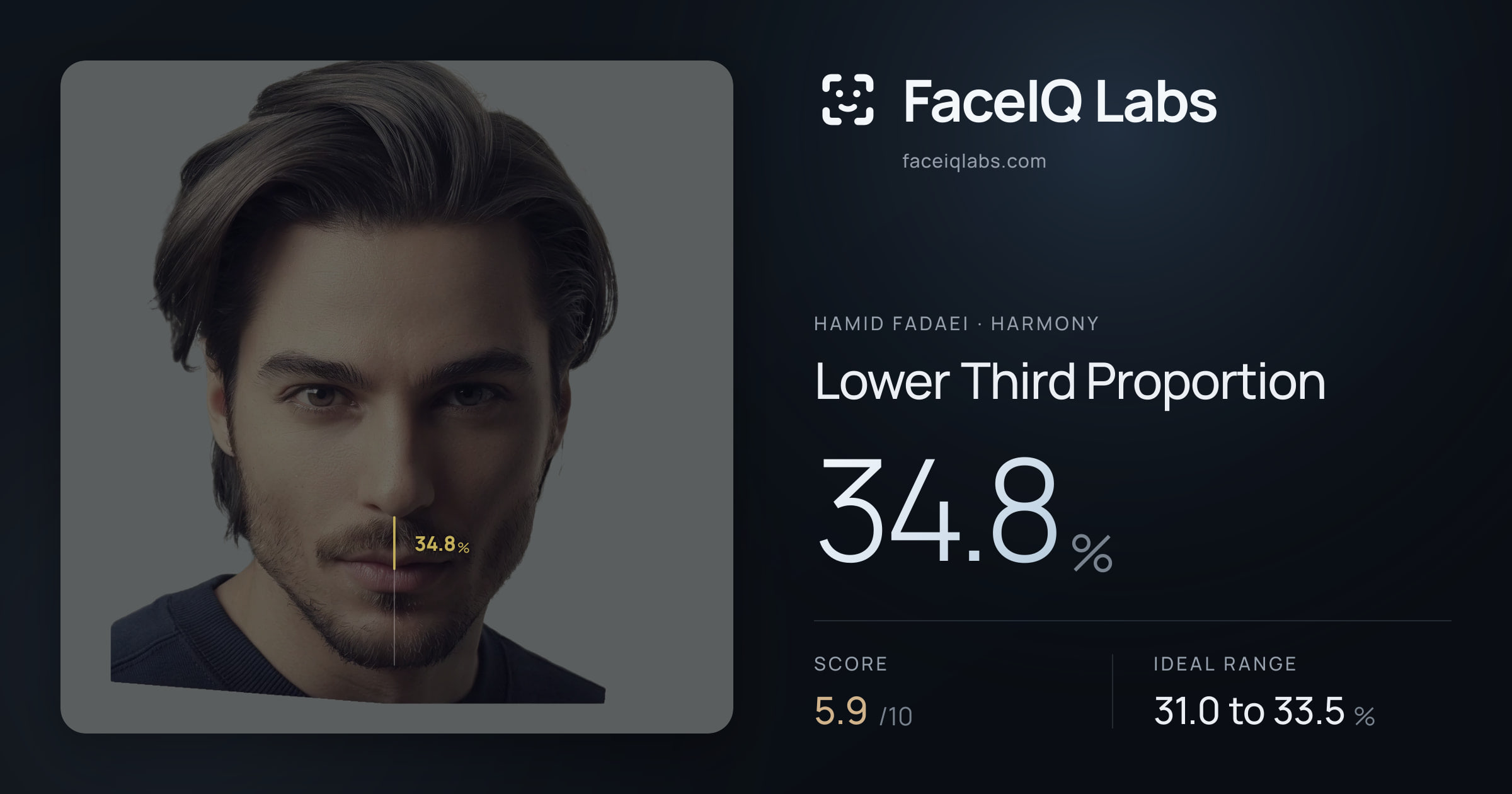 Hamid Fadaei Lower Third Proportion: 34.8%, drawn on the photo