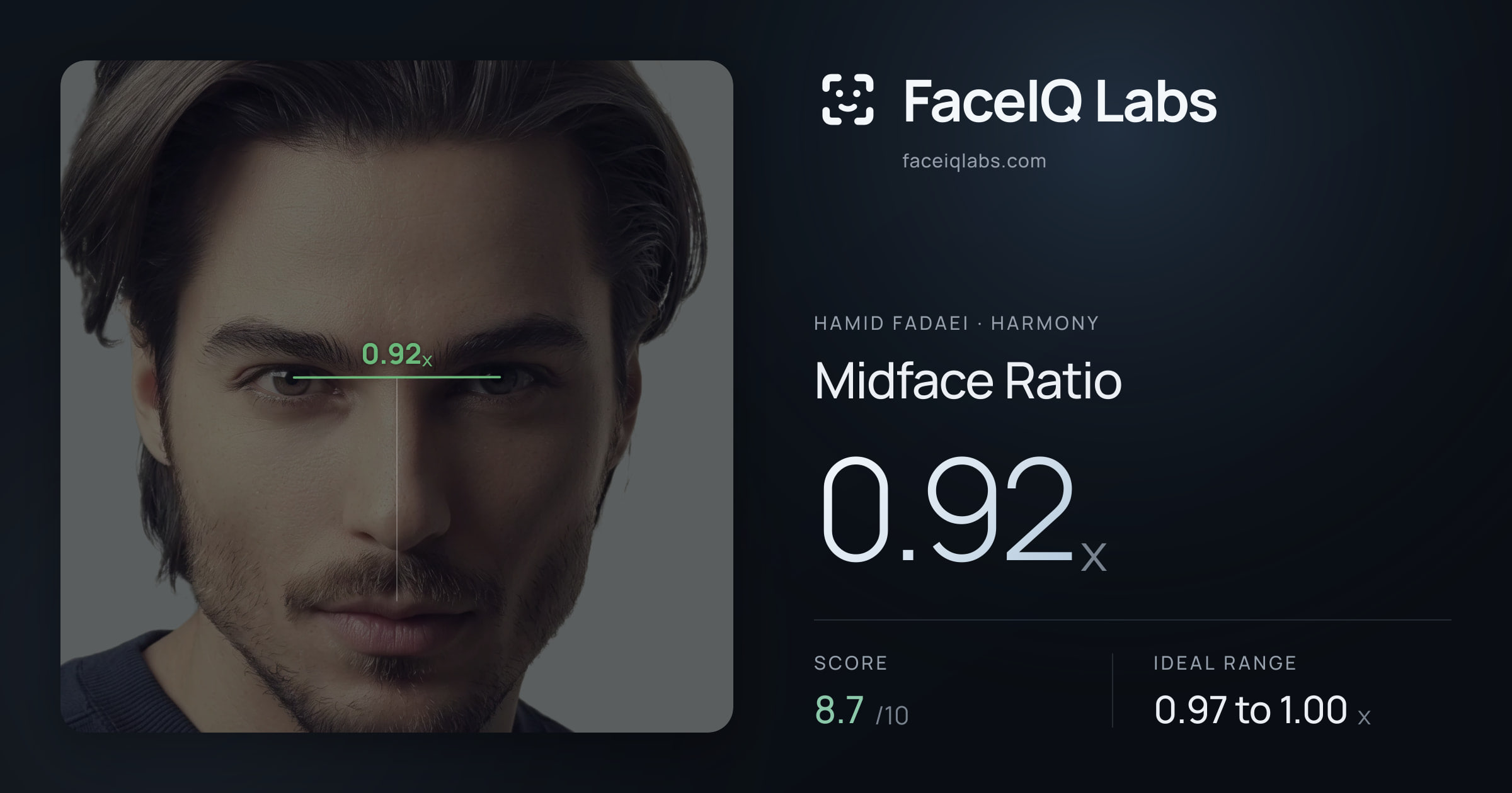 Hamid Fadaei Midface Ratio: 0.92x, drawn on the photo