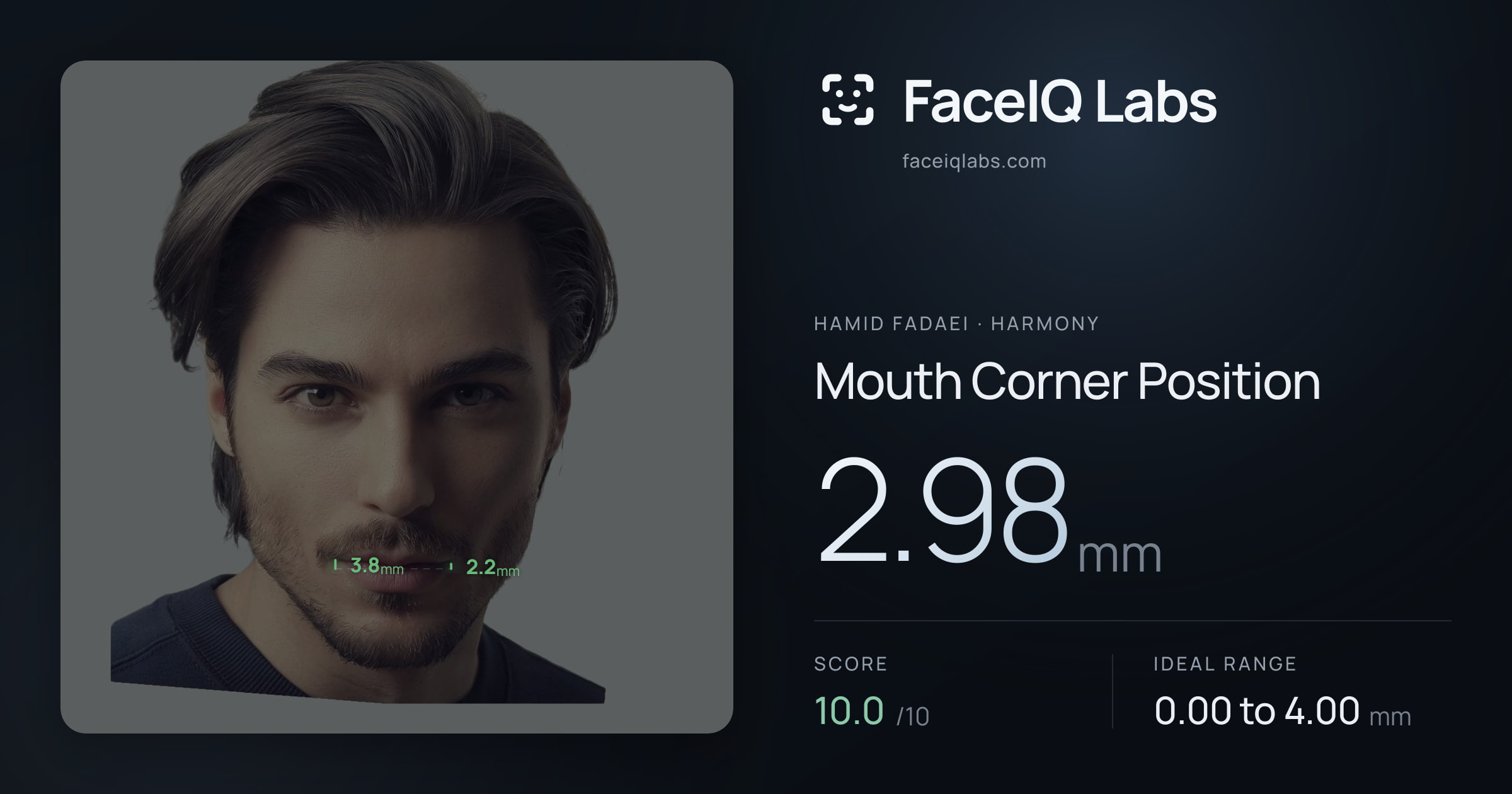 Hamid Fadaei Mouth Corner Position: 2.98mm, drawn on the photo
