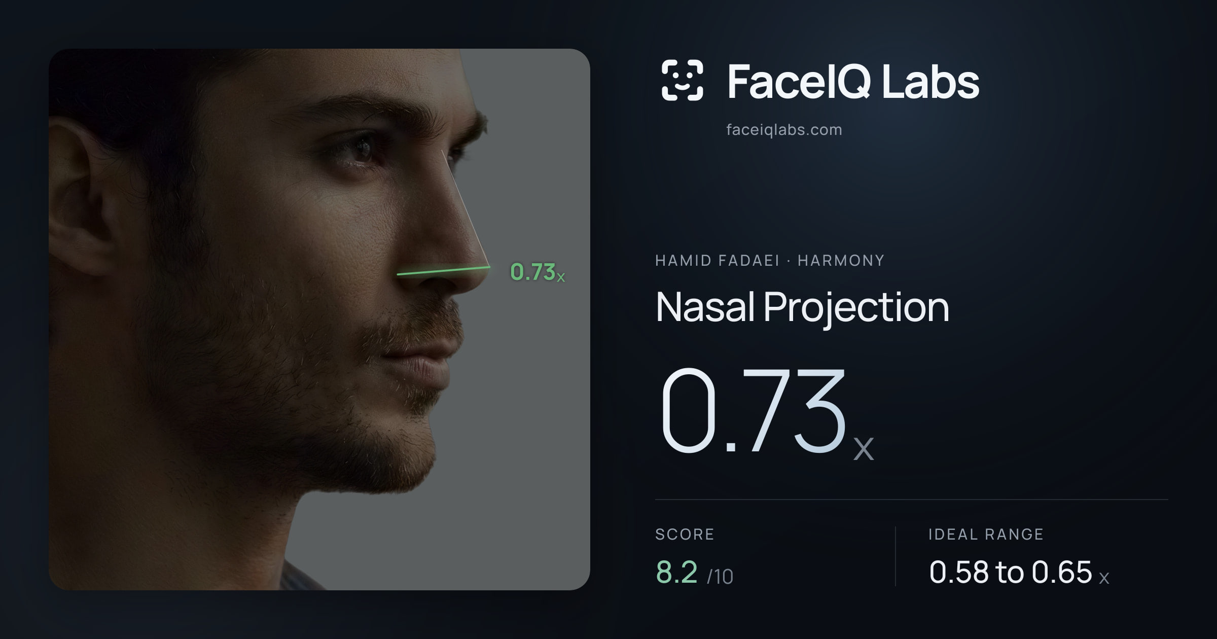 Hamid Fadaei Nasal Projection: 0.73x, drawn on the photo