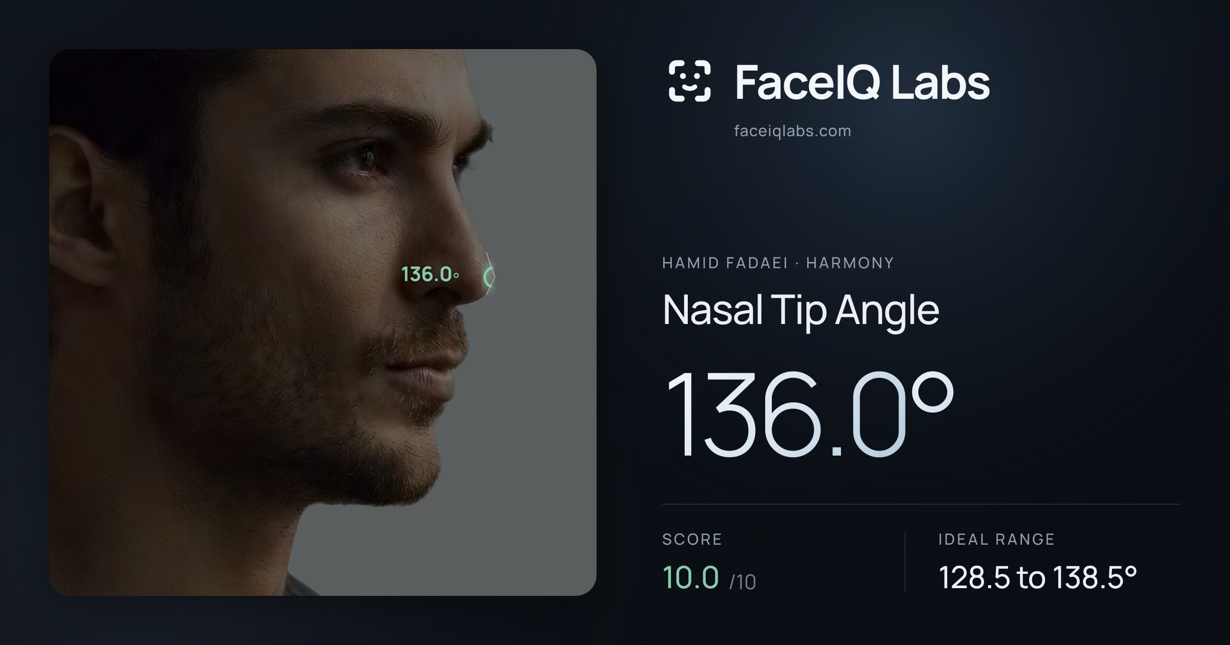 Hamid Fadaei Nasal Tip Angle: 136.0°, drawn on the photo