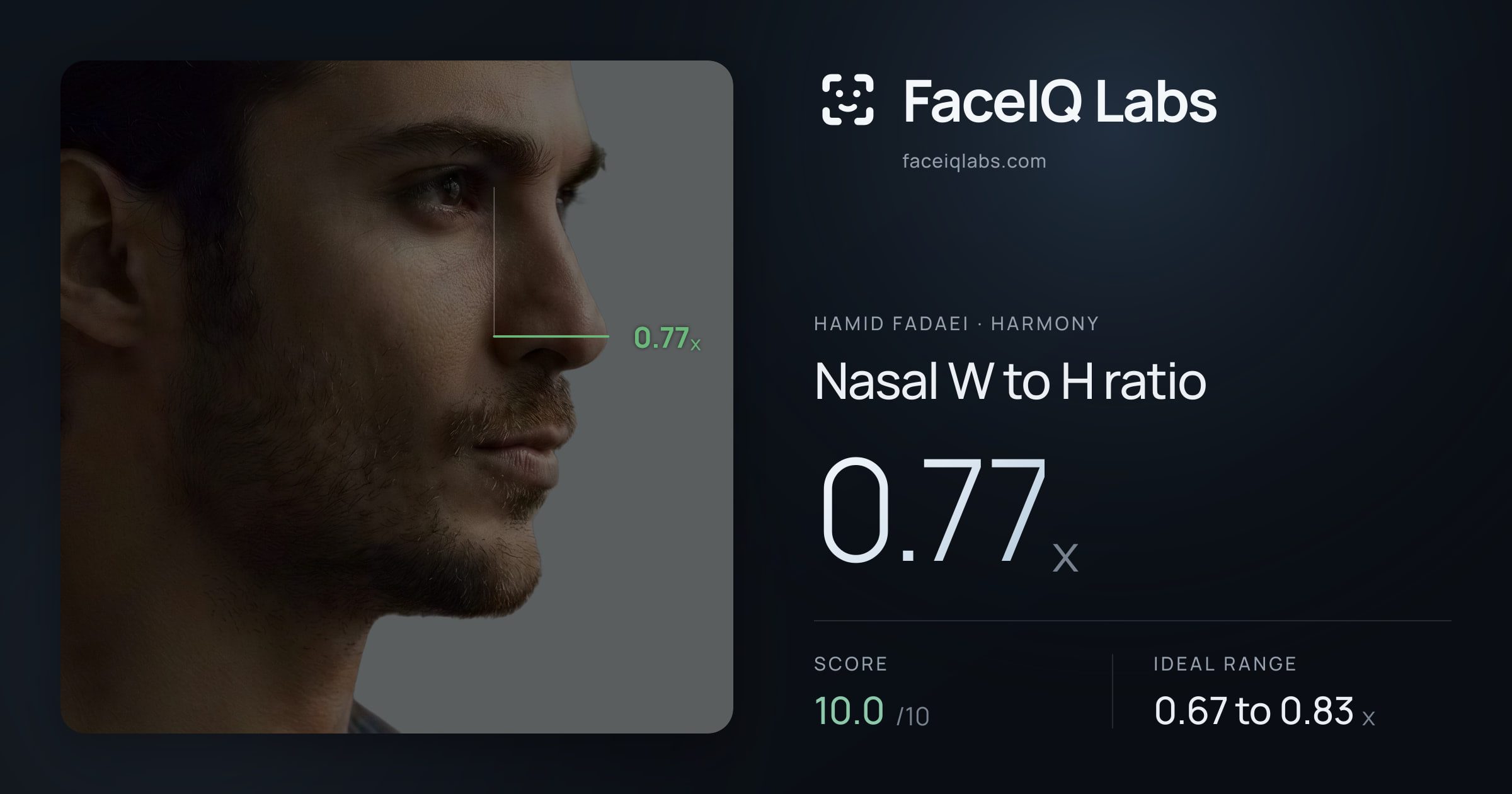 Hamid Fadaei Nasal W to H ratio: 0.77x, drawn on the photo
