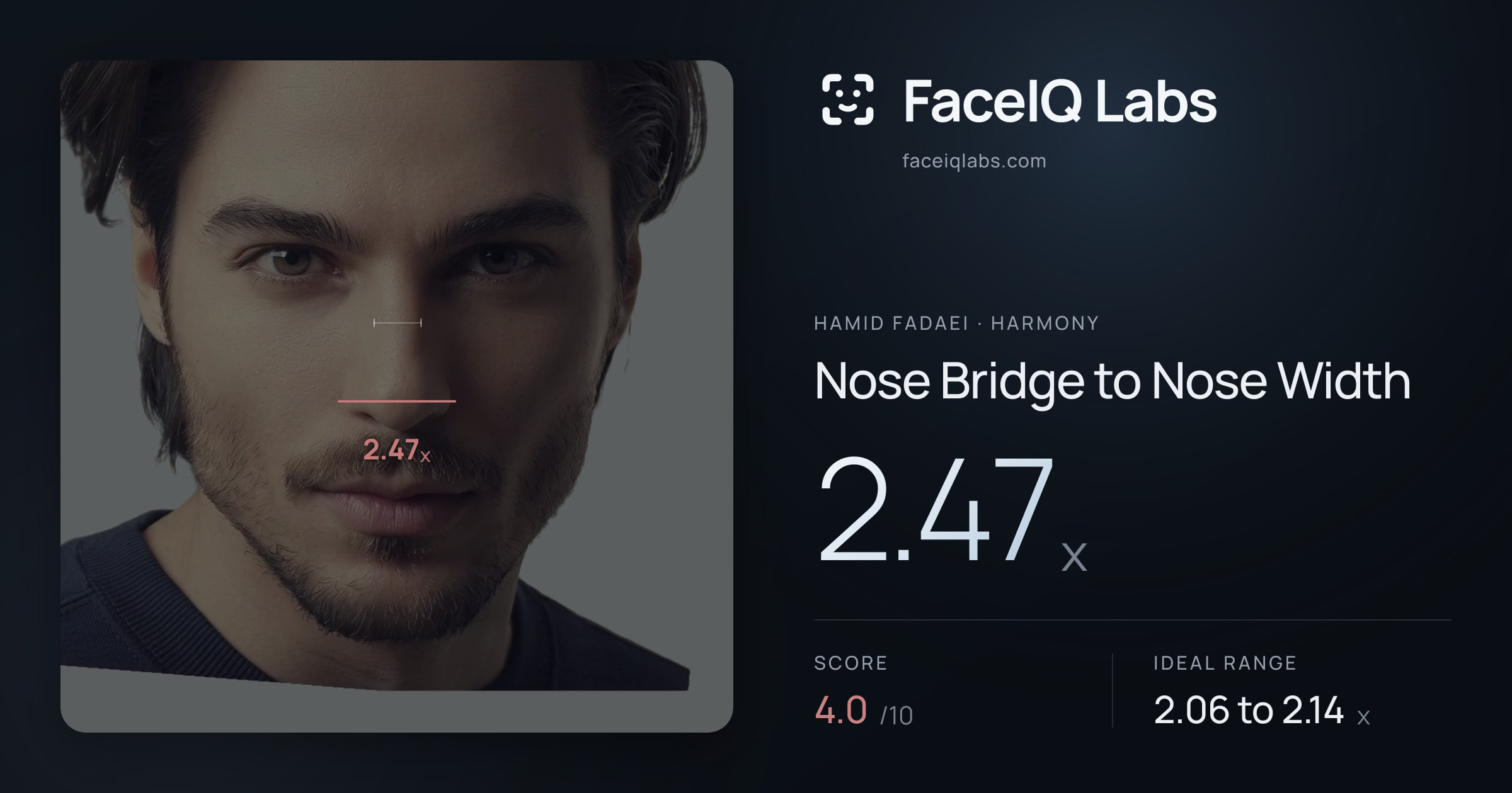 Hamid Fadaei Nose Bridge to Nose Width: 2.47x, drawn on the photo