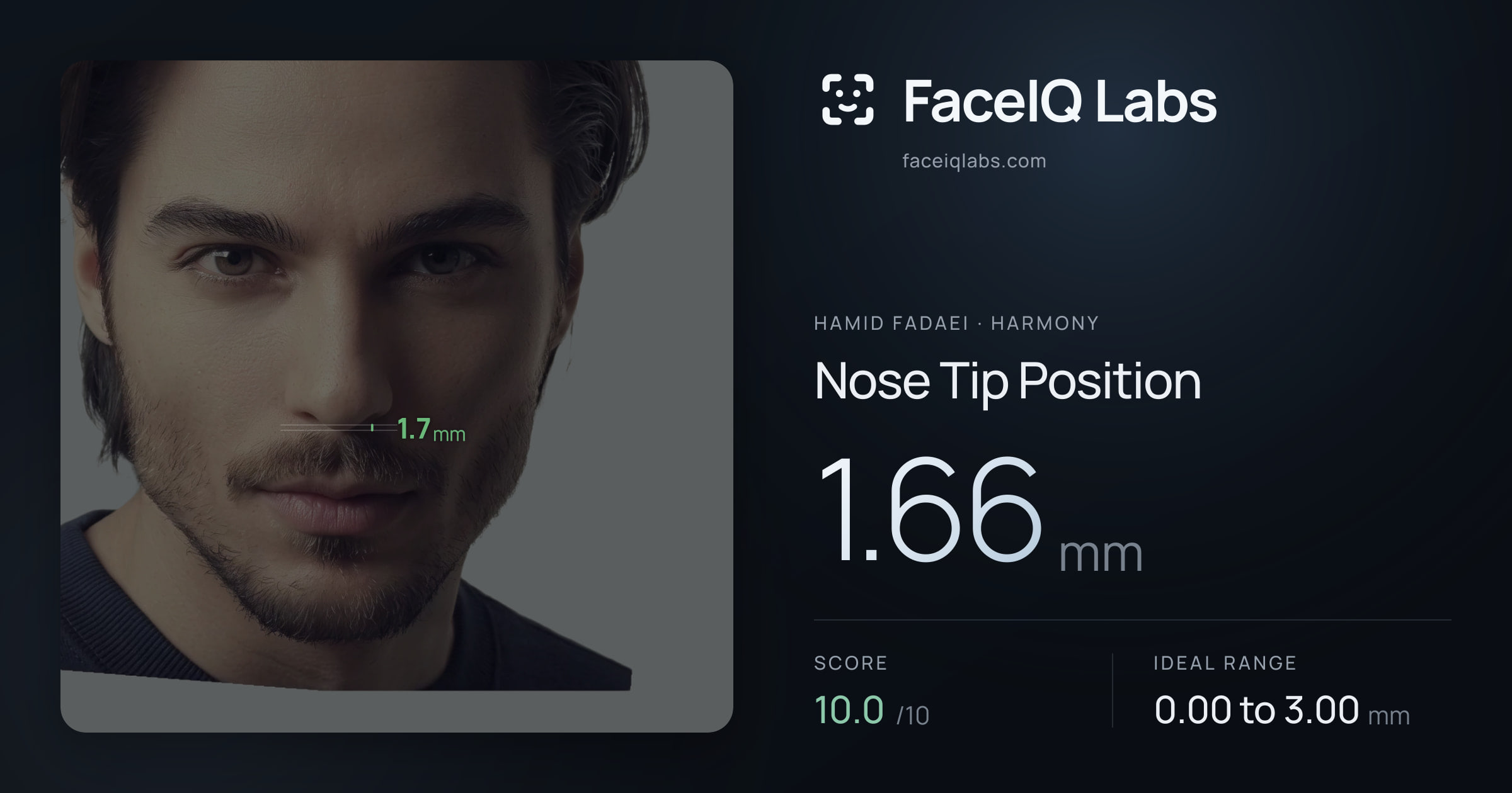 Hamid Fadaei Nose Tip Position: 1.66mm, drawn on the photo