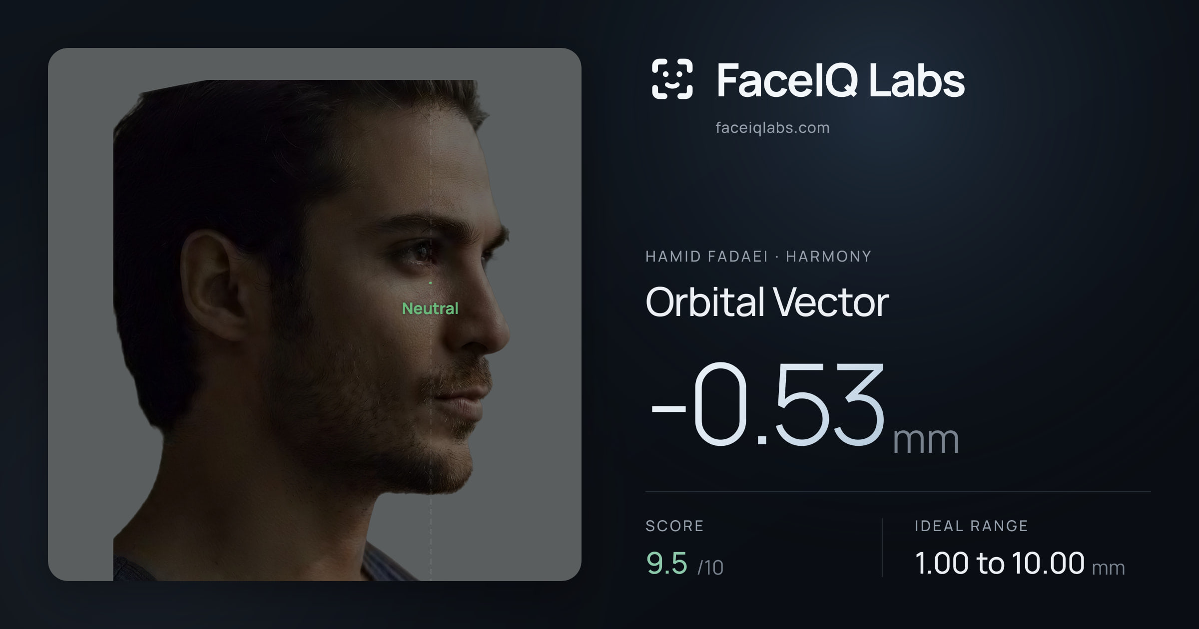 Hamid Fadaei Orbital Vector: -0.53mm, drawn on the photo
