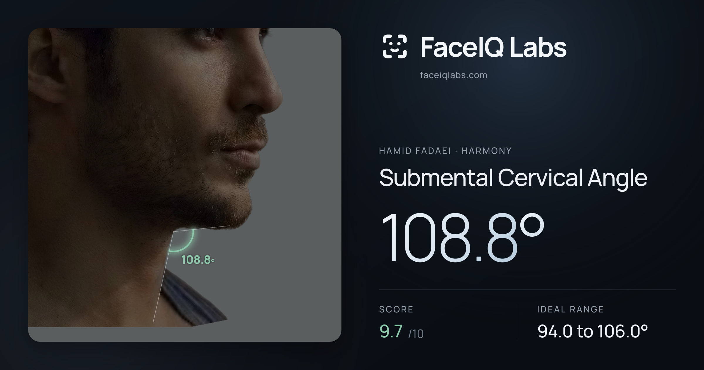 Hamid Fadaei Submental Cervical Angle: 108.8°, drawn on the photo