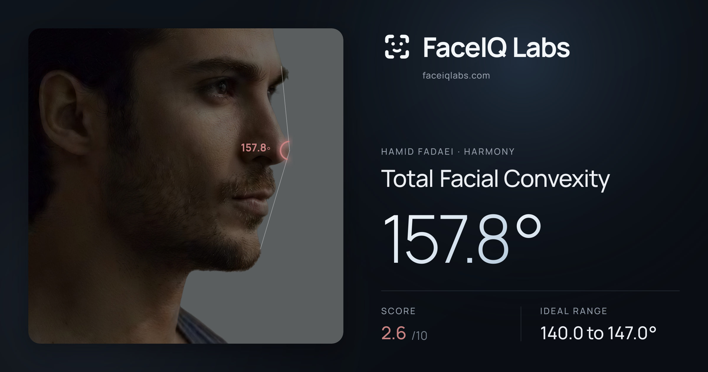 Hamid Fadaei Total Facial Convexity: 157.8°, drawn on the photo